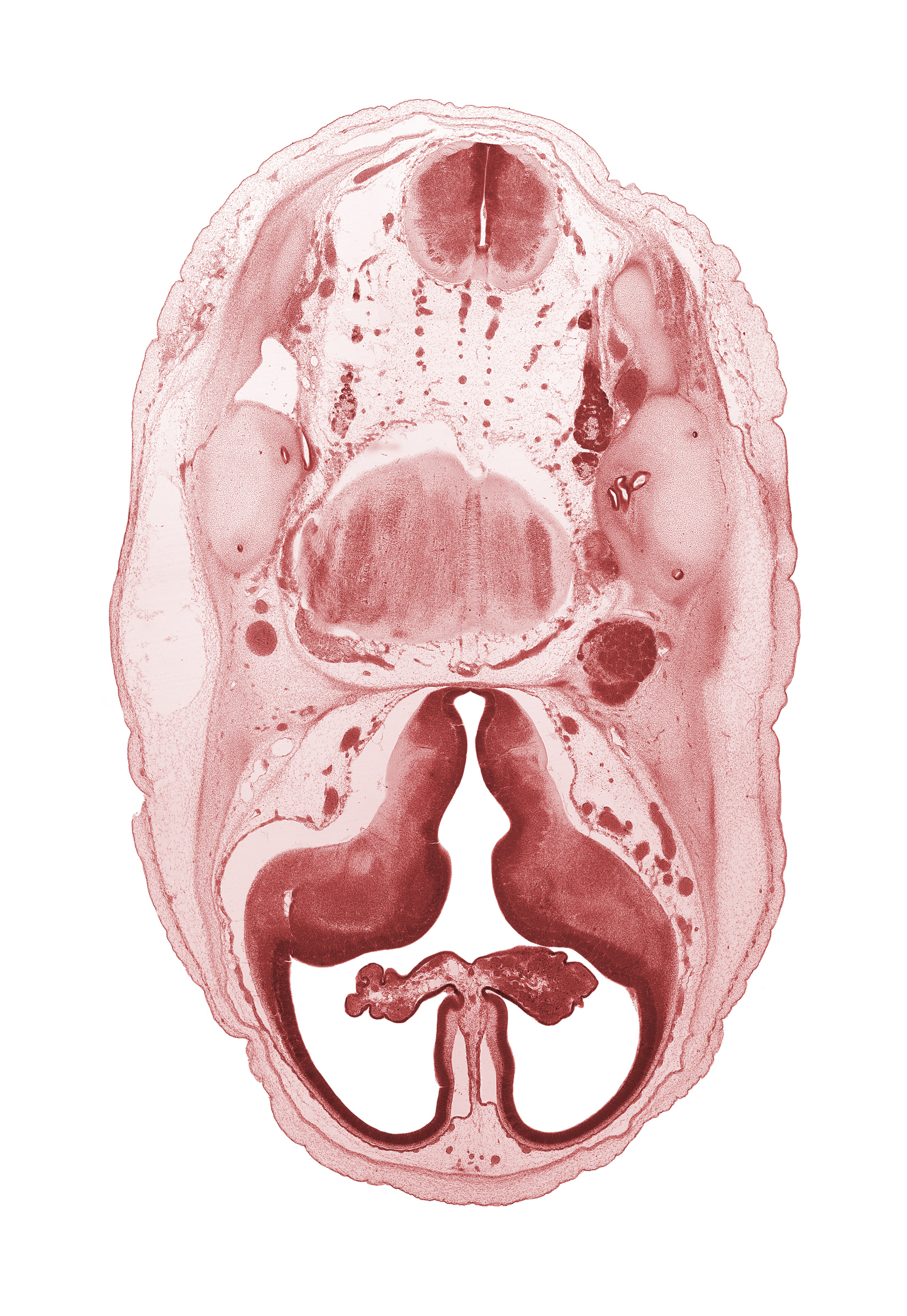 accessory nerve (CN XI), artifact separation(s), basilar artery, central canal, cerebral vesicle (telencephalon), choroid fissure, choroid plexus, hypothalamic sulcus, hypothalamus, internal carotid artery, interventricular foramen, lateral ventricle, lateral ventricular eminence (telencephalon), medial ventricular eminence (diencephalon), motor root of trigeminal nerve (CN V), myelencephalon (medulla oblongata), pyramidal tract region, root of facial nerve (CN VII), semicircular duct, superior ganglion of glossopharyngeal nerve (CN IX), superior ganglion of vagus nerve (CN X)