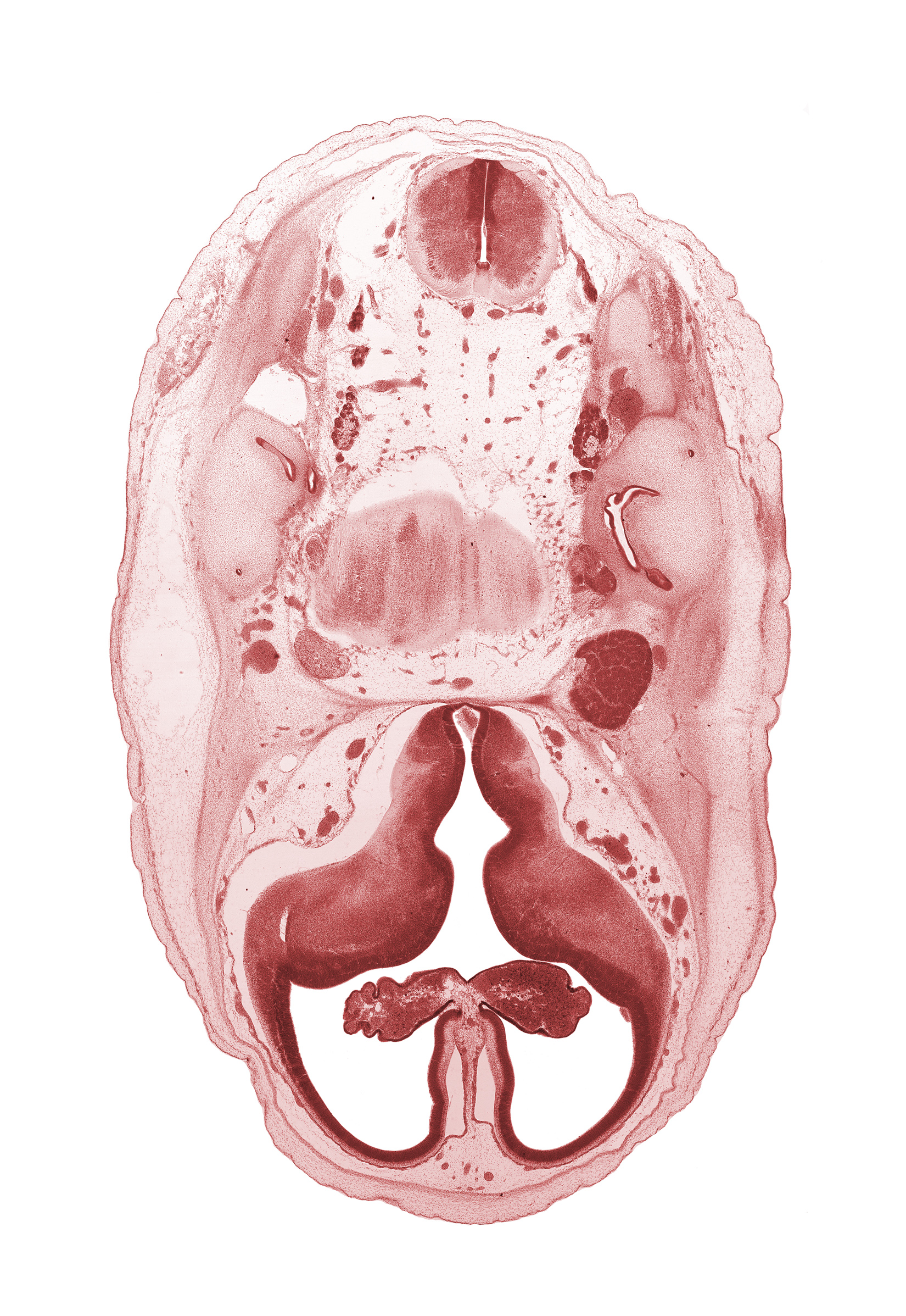 accessory nerve (CN XI), artifact separation(s), choroid plexus, facial nerve (CN VII), glossopharyngeal nerve (CN IX), hypothalamic sulcus, internal carotid artery, interventricular foramen, lateral ventricle, lateral ventricular eminence (telencephalon), medial ventricular eminence (diencephalon), myelencephalon (medulla oblongata), pons region (metencephalon), superior ganglion of vagus nerve (CN X), vestibulocochlear nerve (CN VIII)