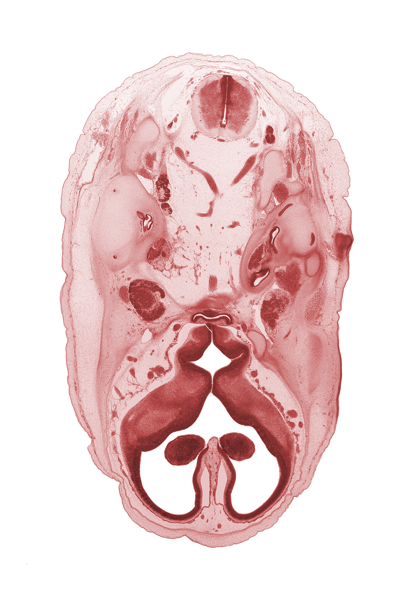 C-1 spinal ganglion, abducens nerve (CN VI), accessory nerve (CN XI), artifact separation(s), auricle, cochlear duct, dorsum sellae region, falx cerebri region, foramen magnum region, hypoglossal nerve (CN XII), hypothalamus, internal carotid artery, internal jugular vein, interventricular foramen, ophthalmic nerve (CN V₁), optic groove, orbitosphenoid, primary head vein, spinal accessory nerve (CN XI), spinal cord, subarachnoid space, third ventricle, trigeminal ganglion (CN V), vagus nerve (CN X), venous plexus(es), vertebral artery