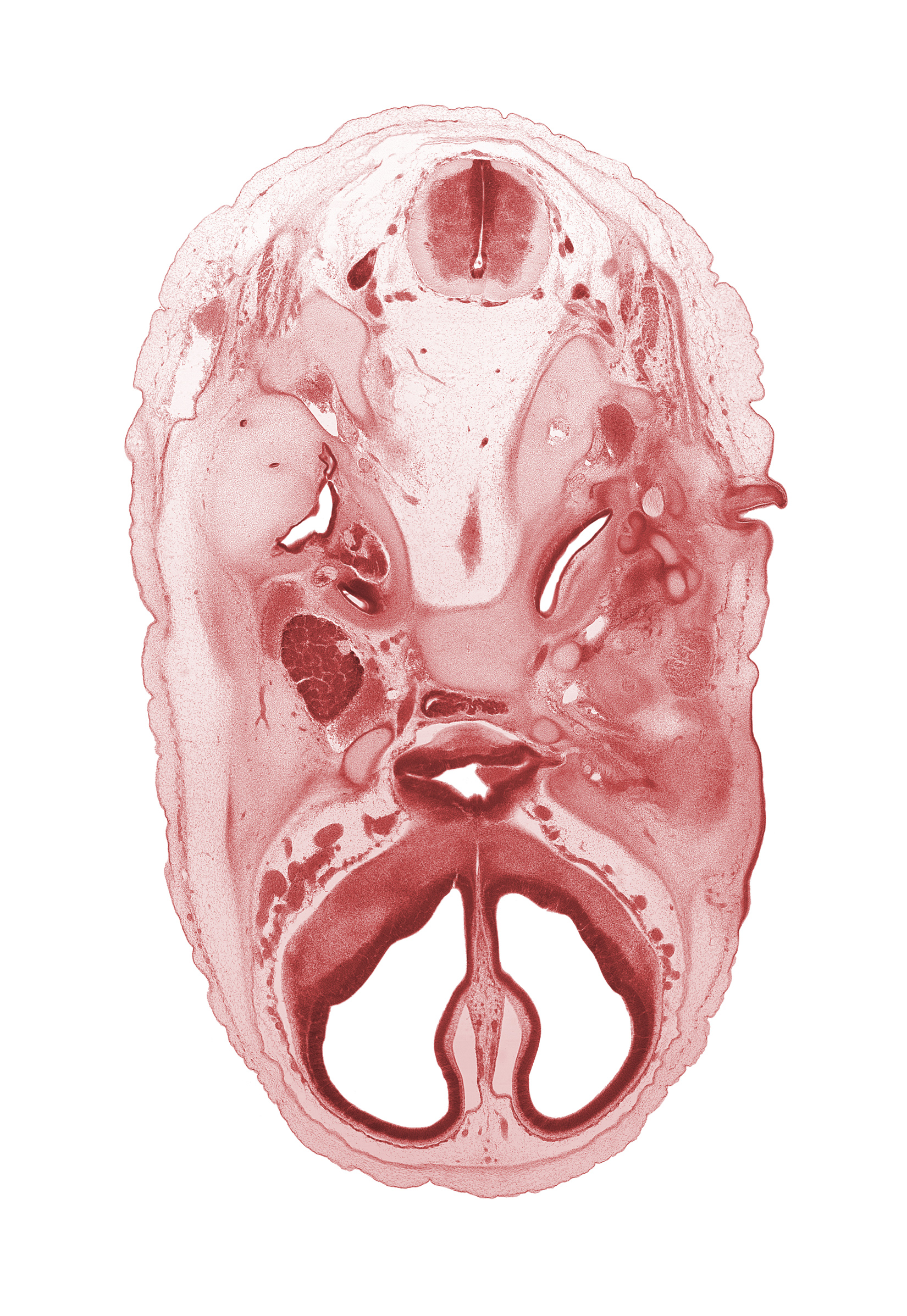 C-1 spinal ganglion, accessory nerve (CN XI), adenohypophysis, artifact separation(s), auricle, basi-occipital (basal plate), cerebral vesicle (telencephalon), cochlear duct, ear ossicle, edge of basilar artery, glossopharyngeal nerve (CN IX), hypoglossal nerve (CN XII), intermediate zone, internal carotid artery, internal jugular vein, lateral ventricle, mandibular nerve (CN V₃), marginal zone, maxillary nerve (CN V₂), ophthalmic nerve (CN V₁), optic canal, optic chiasma (chiasmatic plate), optic nerve (CN II), orbitosphenoid, spinal accessory nerve (CN XI), subarachnoid space, third ventricle, vagus nerve (CN X), ventricular zone