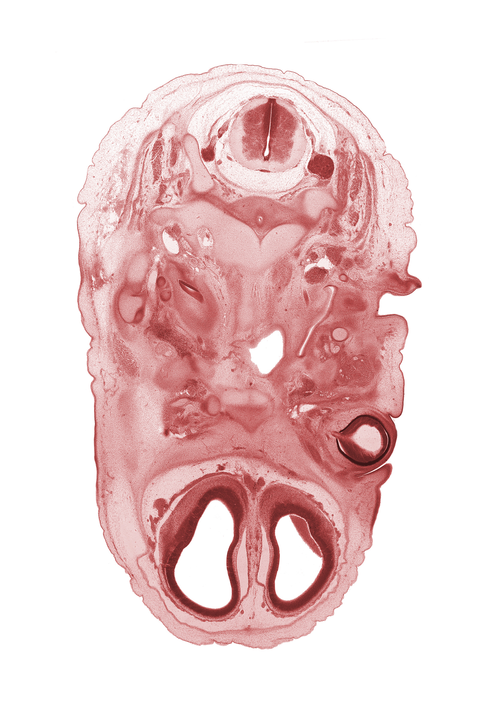 C-2 dorsal root, C-2 spinal ganglion, anterior communicating artery, artifact separation(s), atlanto-occipital joint, basi-occipital (basal plate), basisphenoid, dens of C-2 vertebra (axis), edge of cochlear duct, edge of pharynx, facial nerve (CN VII), hypoglossal nerve (CN XII), inferior ganglion of glossopharyngeal nerve (CN IX), internal jugular vein, lateral ventricle, malleus cartilage, maxillary nerve (CN V₂), maxillary vein, olfactory bulb, optic nerve (CN II), osteogenic layer, semispinalis cervicis muscle, upper eyelid, vagus nerve (CN X), vertebral artery