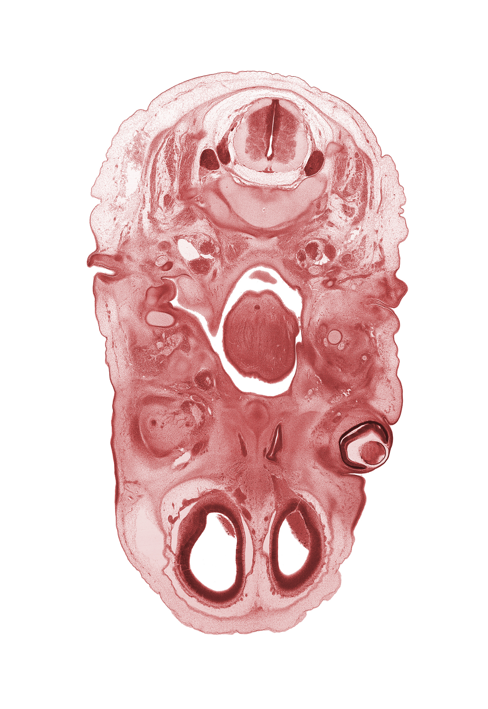 C-3 dorsal root, C-3 spinal ganglion, anterior cerebral artery, artifact separation(s), blastema of medial rectus muscle, blastemata of tongue muscles, cerebral vesicle (telencephalon), edge of epiglottis, edge of nasal cavity (nasal sac), edge of palatine shelf, glossopharyngeal nerve (CN IX), inferior ganglion of vagus nerve (CN X), internal jugular vein, lateral ventricle, nasopharynx, osteogenic layer, pharyngotympanic tube, superior cervical sympathetic ganglion, supra-orbital vein, thyroglossal duct, vertebral artery