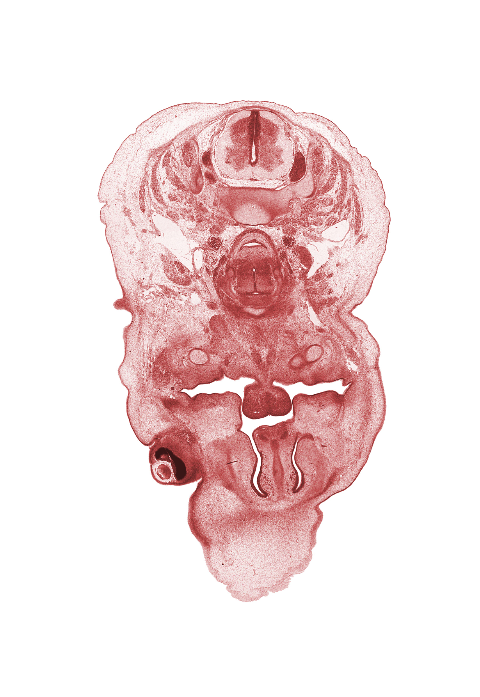 C-5 spinal ganglion, blastema of facial muscle, body of tongue, caudal edge of auricle, central canal, choana, frontal prominence, inferior ganglion of vagus nerve (CN X), internal carotid artery, internal jugular vein, interorbital groove, interorbital ligament, jugular lymph sac, laryngeal condensation, middle cervical sympathetic ganglion, neural arch of C-4 vertebra, palatine shelf, platysma muscle, retropharyngeal space, surface ectoderm