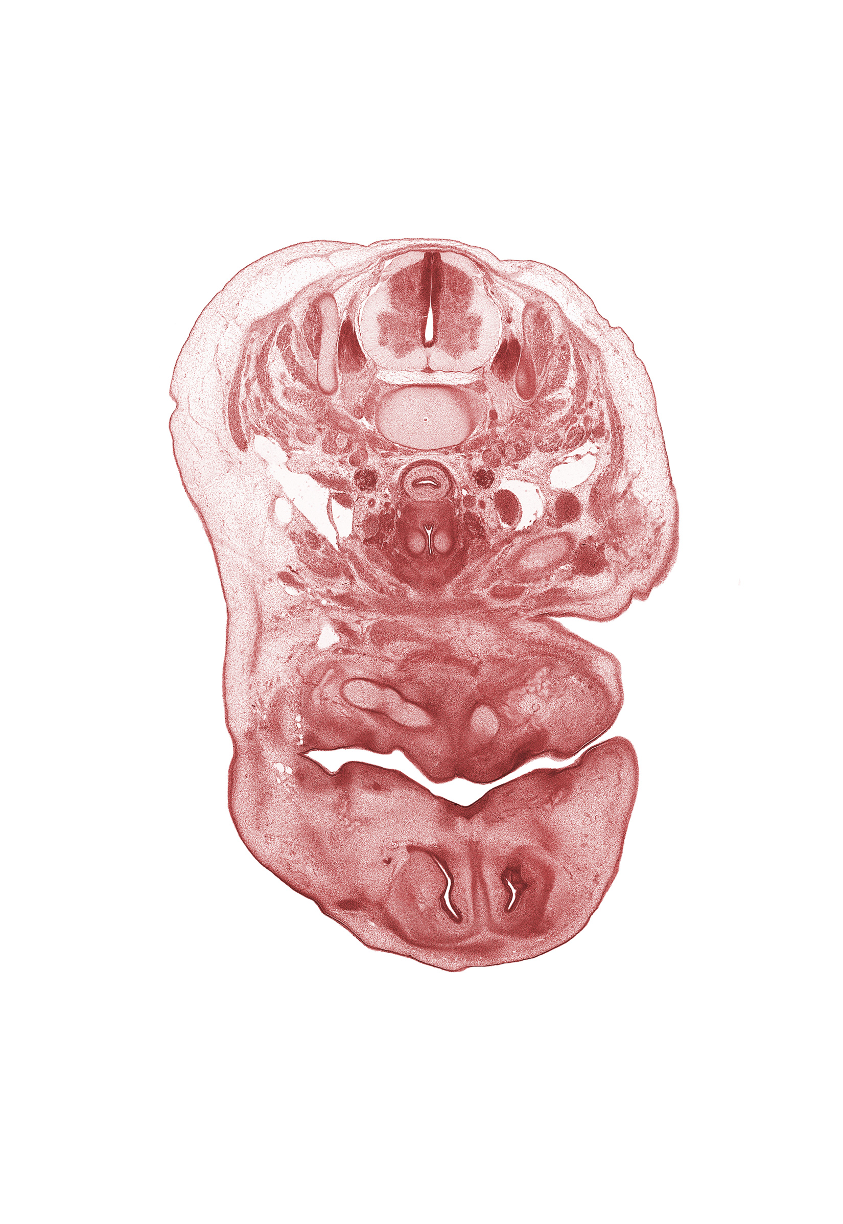 C-5 spinal ganglion, angle of mouth, edge of clavicle, external jugular vein, inferior ganglion of vagus nerve (CN X), inferior nasal concha, inferior parathyroid gland, infraglottic cavity, internal carotid artery, interorbital ligament, laryngeal cartilage, nasal capsule, nasal cavity (nasal sac), nasal septal cartilage, neural arch, pharyngeal arch 1 cartilage (Meckel), primary palate, semispinalis capitis muscle, semispinalis cervicis muscle, splenius muscle, thyroid gland, trapezius muscle, vertebral artery