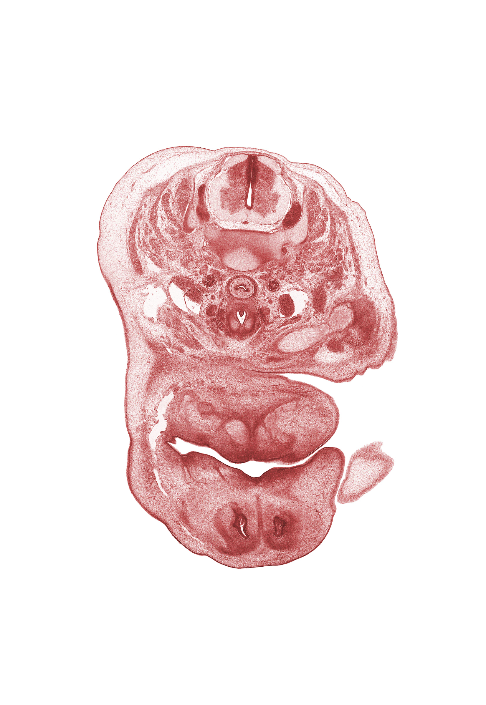 C-6 spinal ganglion, clavicle, edge of pharyngeal arch 1 cartilage (Meckel), epithelial plug in naris, esophagus endoderm, inferior ganglion of vagus nerve (CN X), inferior parathyroid gland, intermediate zone, internal carotid artery, lower lip, marginal zone, nasal cavity (nasal sac), nose, oral cavity, shoulder, sternocleidomastoid muscle, subarachnoid space, thyroid gland, trapezius muscle, upper limb, upper lip, ventricular zone