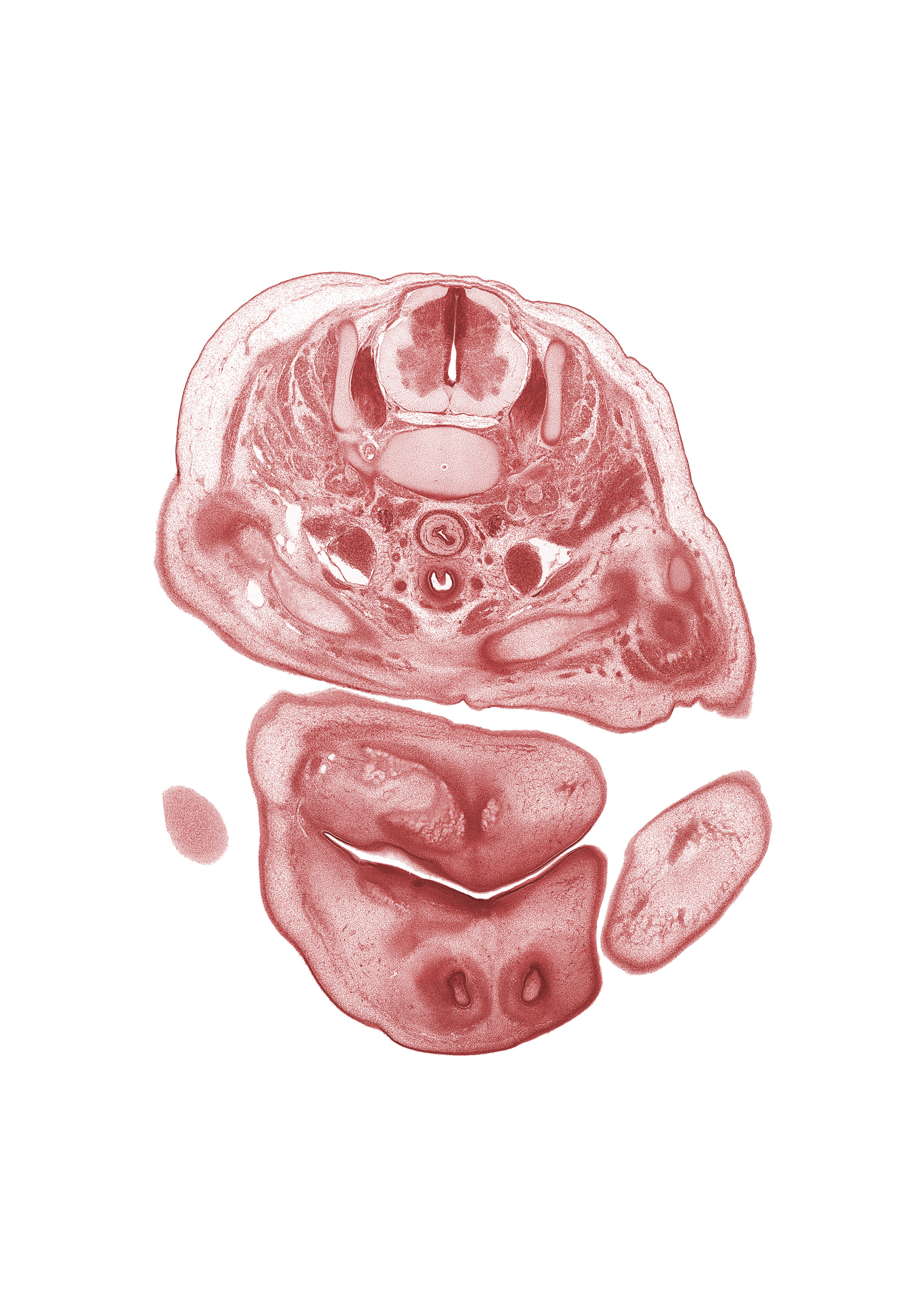 C-6 spinal ganglion, C-6 spinal nerve, blastema of facial muscle, clavicle, edge of upper limb, inferior parathyroid gland, internal carotid artery, internal jugular vein, isthmus of thyroid gland, middle scalene muscle, neural arch, nose, notochord, osteogenic layer, primary palate, suprasternal region, surface ectoderm of upper limb, trapezius muscle