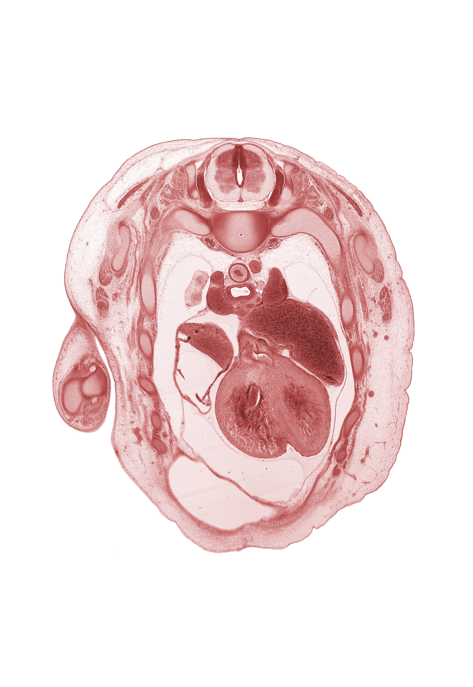 T-2 spinal ganglion, anterior interventricular sulcus, anterior spinal artery, aorta, aortic semilunar valve, azygos vein, caudal segment of left precardinal vein, central tendon of diaphragm, head of rib 3, left atrium, musculi pectinati in wall of right auricle, neural arch, peritoneal cavity, phrenic nerve, rib 4, subarachnoid space, superior vena cava, trabecular part of left ventricle, trabecular part of right ventricle, tracheal bifurcation, trapezius muscle, upper lobe of right lung