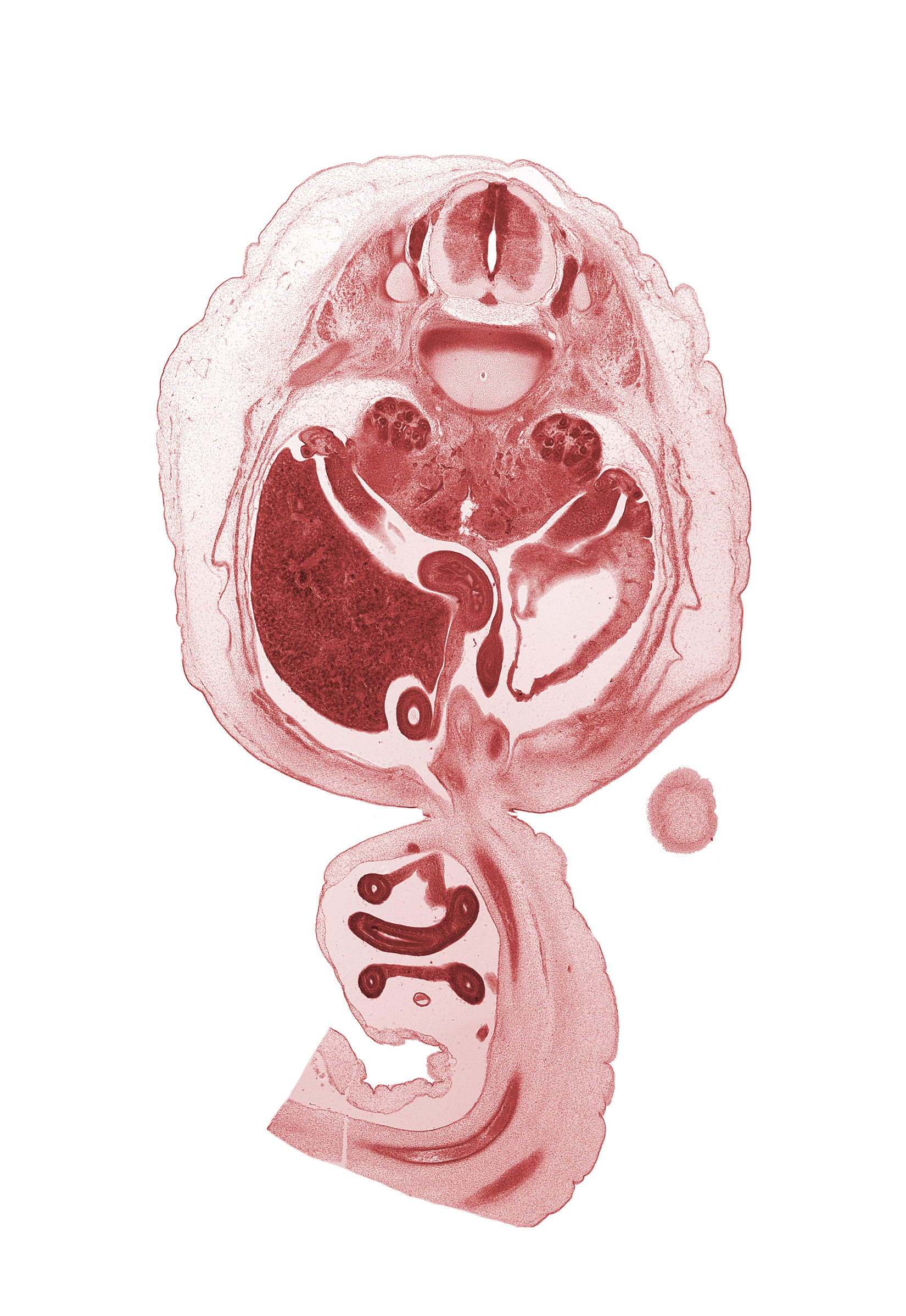 T-12 / L-1 intervertebral disc, T-12 spinal ganglion, T-12 spinal nerve, allantois, aorta, centrum of L-1 vertebra, cephalic edge of lower limb, duodenum, hindgut (colon), jejunum, kidney (metanephros), left umbilical artery, lesser sac (omental bursa), mesentery, mesocolon, proximal limb of herniated midgut, right umbilical artery, superior pole of right kidney (metanephros), testis