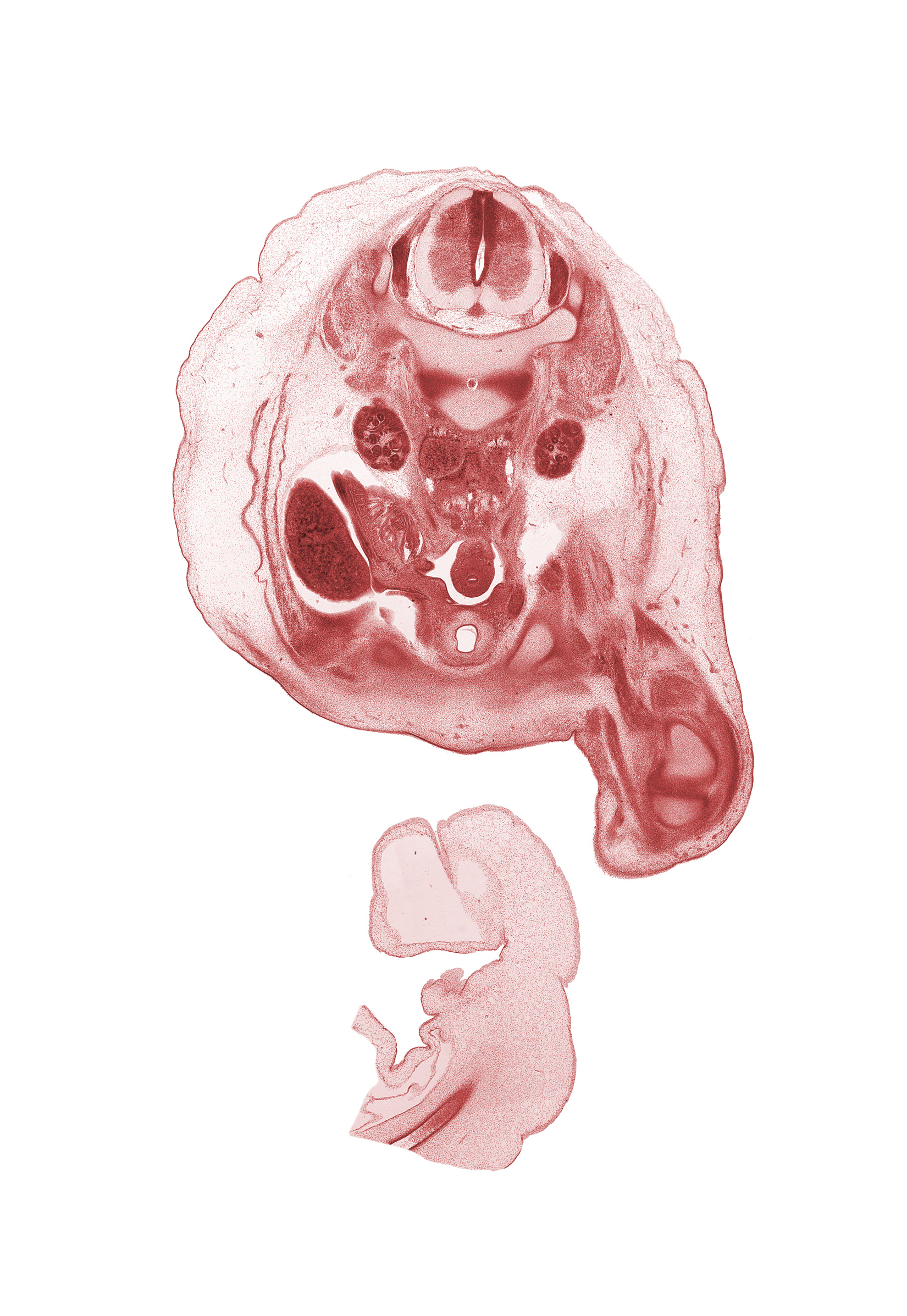 L-2 / L-3 intervertebral disc, L-2 spinal ganglion, L-2 ventral root, amnion on surface of umbilical cord, aorta, caudal edge of liver, epididymis, external abdominal oblique muscle, gubernaculum of testis, inferior pole of kidney (metanephros), inferior vena cava (subcardinal vein), internal abdominal oblique muscle, medial condyle of tibia, medial epicondyle of femur, pubis, testis, transversus abdominis muscle, umbilical coelom, ureter, urinary bladder, vas deferens (mesonephric duct)