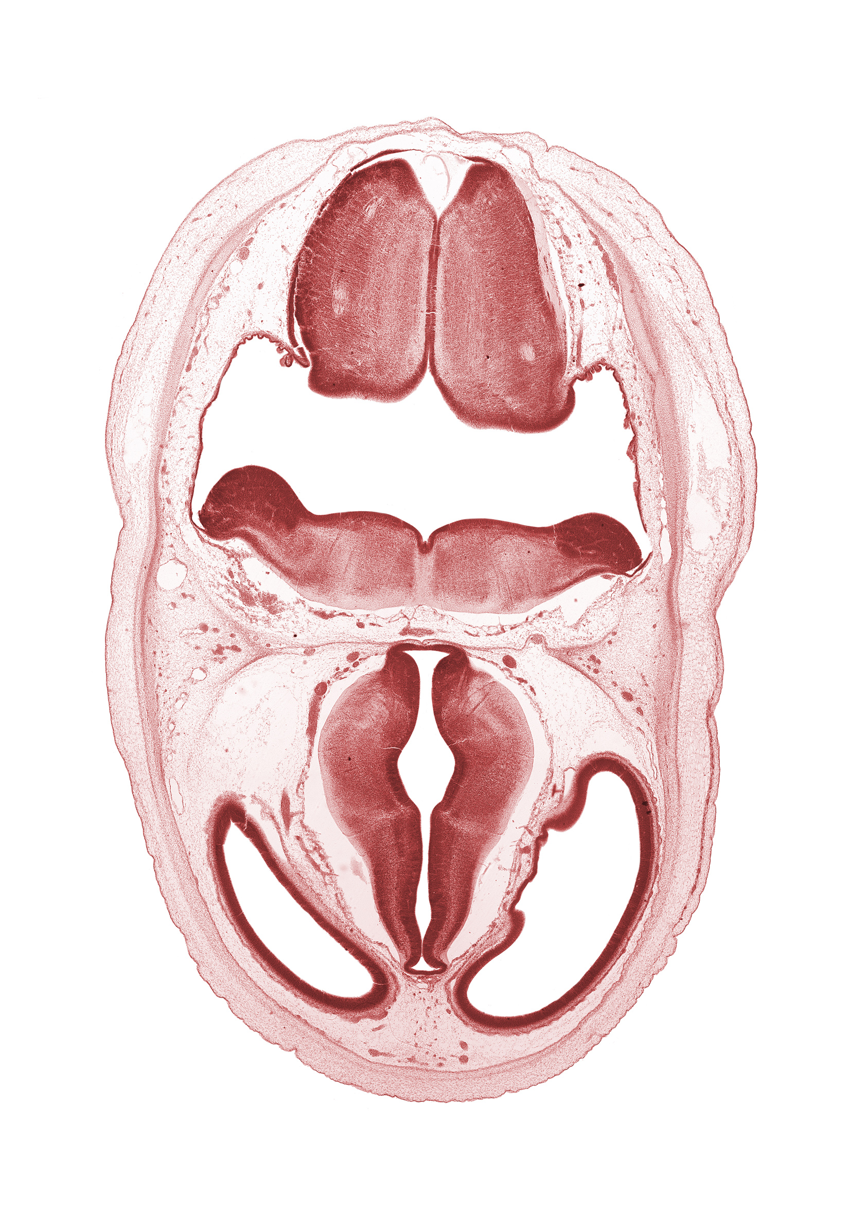 artifact separation(s), basilar artery, cerebral vesicle (telencephalon), dorsal thalamus, hypothalamic sulcus, hypothalamus, osteogenic layer, pons region (metencephalon), posterior communicating artery, rhombencoel (fourth ventricle), roof plate, subarachnoid space, ventral thalamus, zona limitans intrathalamica