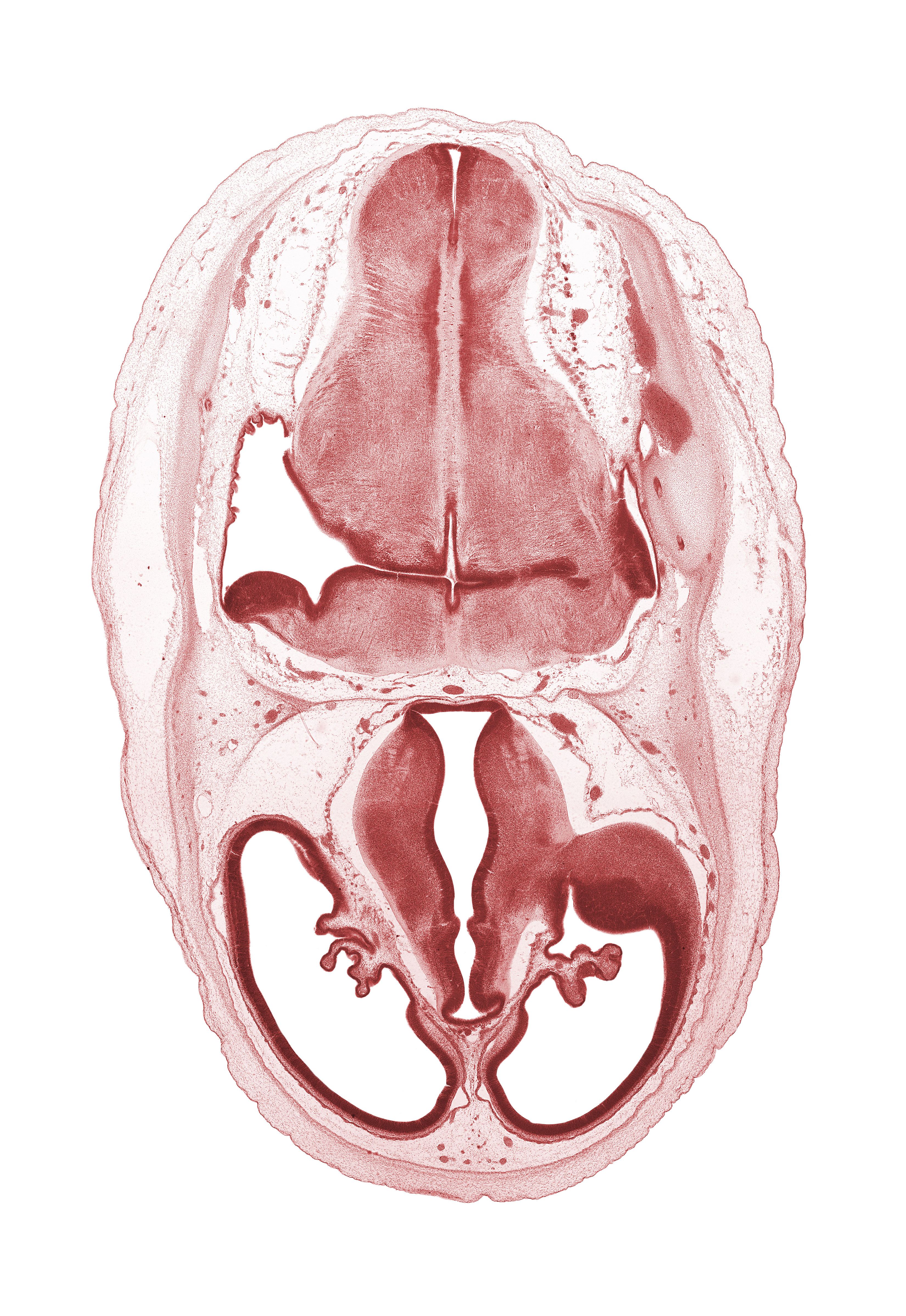 artifact separation(s), basilar artery, dorsal thalamus, endolymphatic sac, hypothalamic sulcus, hypothalamus, junction of central canal and obex, lateral recess of rhombencoel (fourth ventricle), marginal ridge, pons region (metencephalon), sensory decussation, sulcus dorsalis, third ventricle, venous plexus(es), ventral thalamus