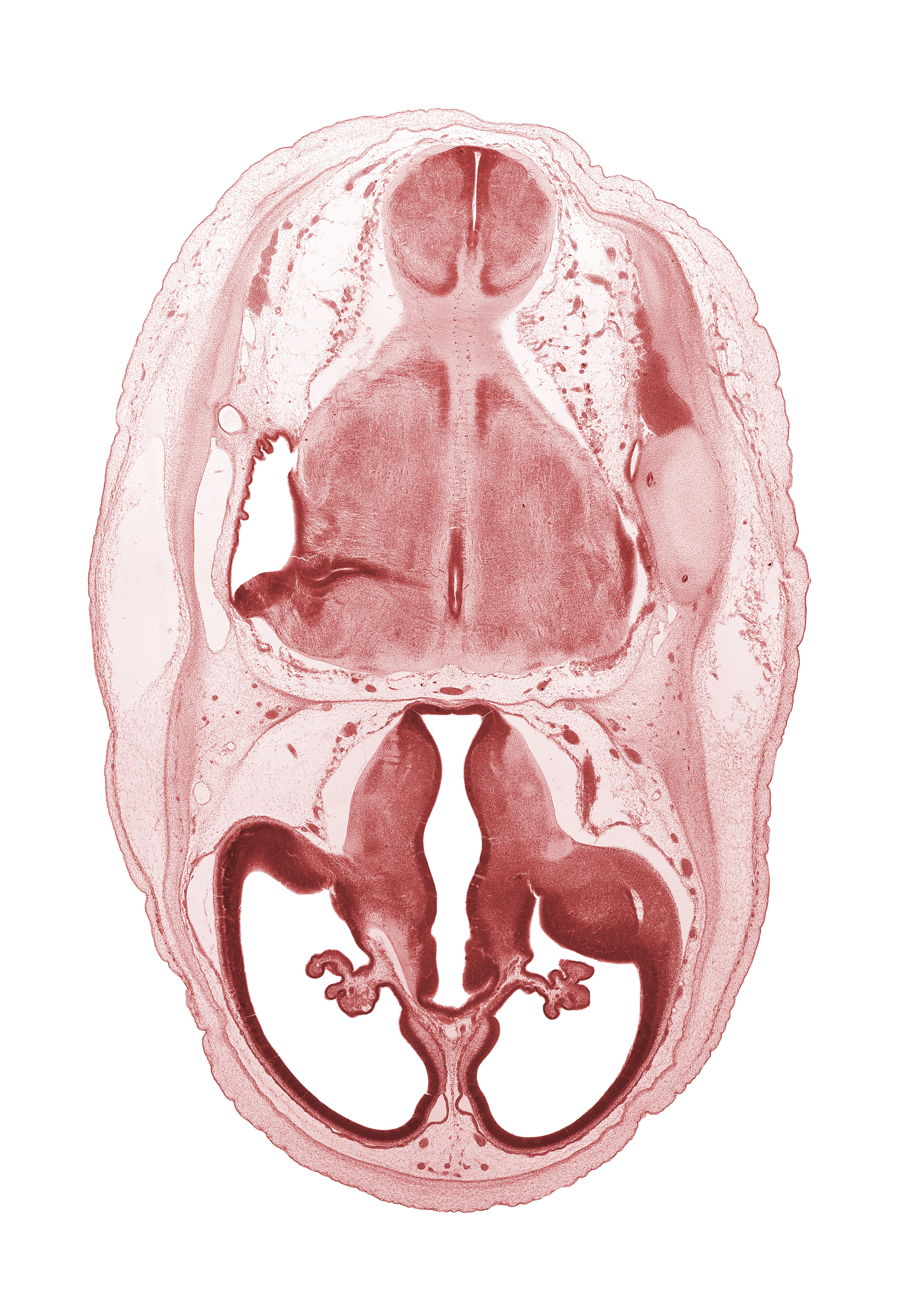 basilar artery, choroid fissure, choroid plexus, dural band for tentorium cerebelli, edge of rhombencoel (fourth ventricle), endolymphatic sac, intermediate zone, lateral ventricle, lateral ventricular eminence (telencephalon), marginal zone, myelencephalon (medulla oblongata), posterior communicating artery, pyramidal tract region, rhombencoel (fourth ventricle), roof of diencephalon, root of trigeminal nerve (CN V), stem of posterior dural venous plexus, third ventricle, ventricular zone