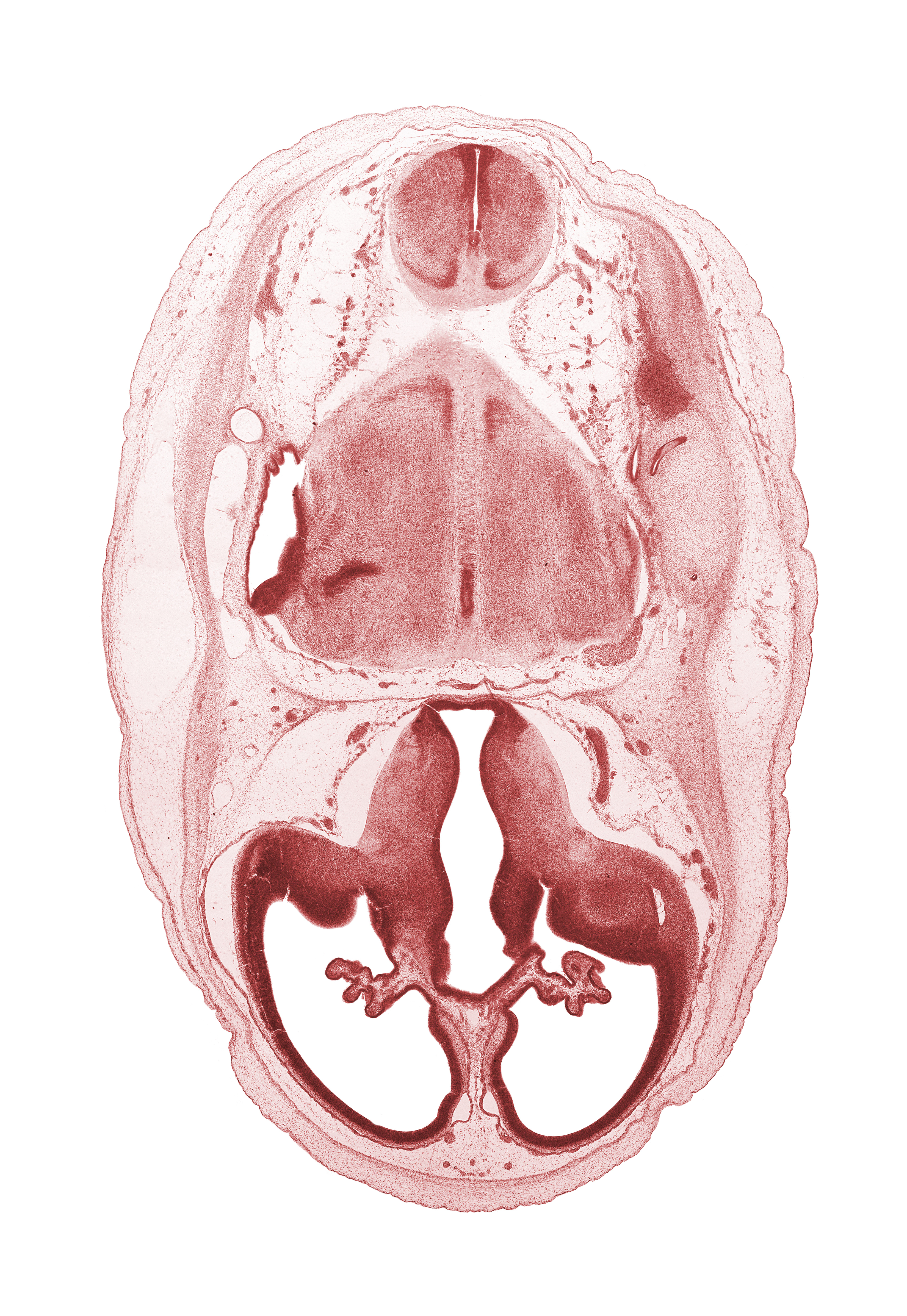 artifact separation(s), central canal, choroid fissure, choroid plexus, dural band for tentorium cerebelli, endolymphatic sac, falx cerebri region, hypothalamus, junction of internal carotid and posterior communicating arteries, lateral recess of rhombencoel (fourth ventricle), lateral ventricle, myelencephalon (medulla oblongata), pyramidal tract region, region of cervical flexure, spinal tract of trigeminal nerve (CN V), sulcus terminalis, third ventricle