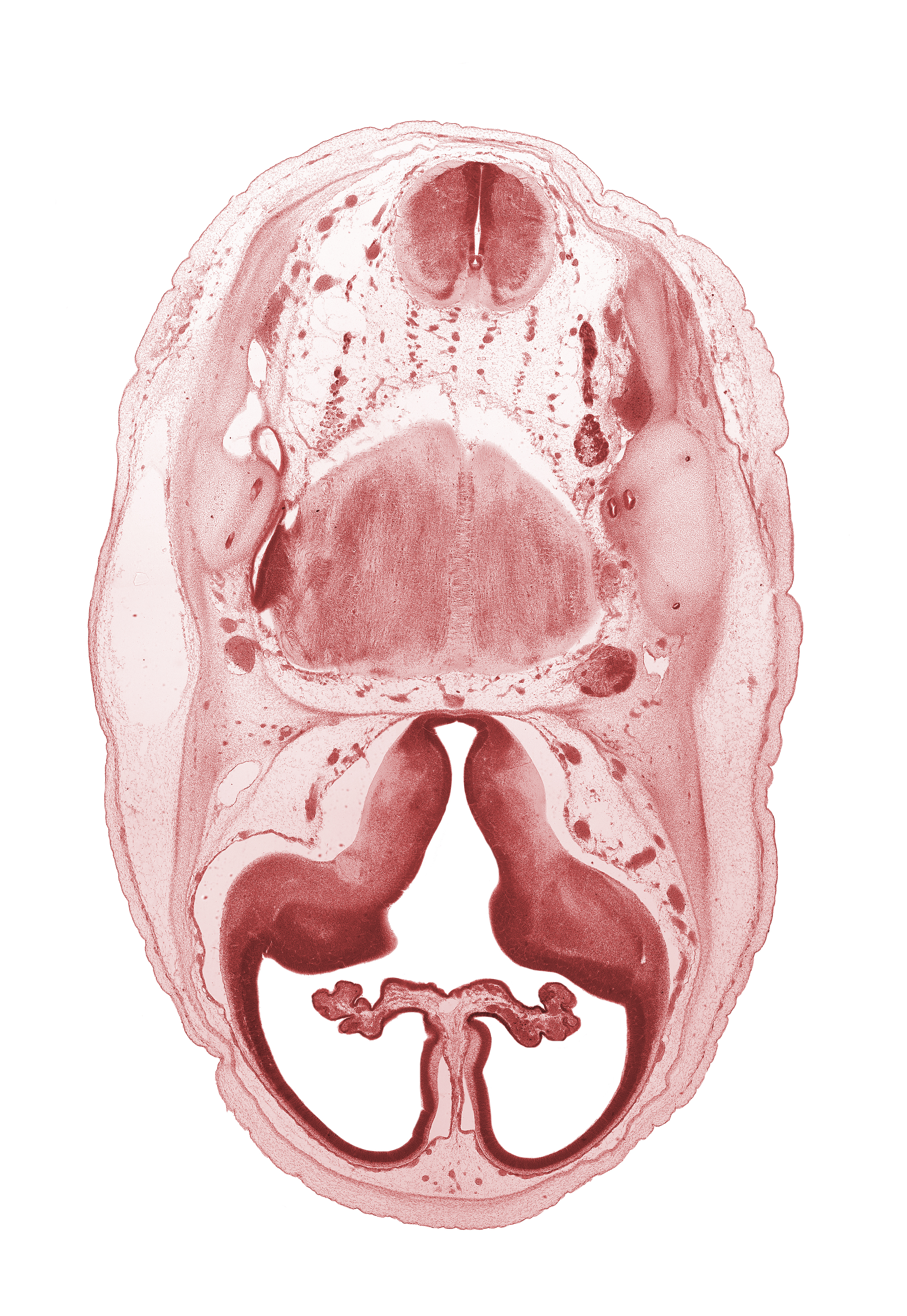 accessory nerve (CN XI), artifact separation(s), basilar artery, choroid fissure, choroid plexus, falx cerebri region, hypothalamic sulcus, hypothalamus, intermediate zone, interventricular foramen, lateral ventricular eminence (telencephalon), marginal zone, medial ventricular eminence (diencephalon), myelencephalon (medulla oblongata), pons region (metencephalon), pyramidal tract region, root of accessory nerve (CN XI), root of glossopharyngeal nerve (CN IX), root of vestibulocochlear nerve (CN VIII), superior ganglion of vagus nerve (CN X), trigeminal nerve (CN V), ventricular zone