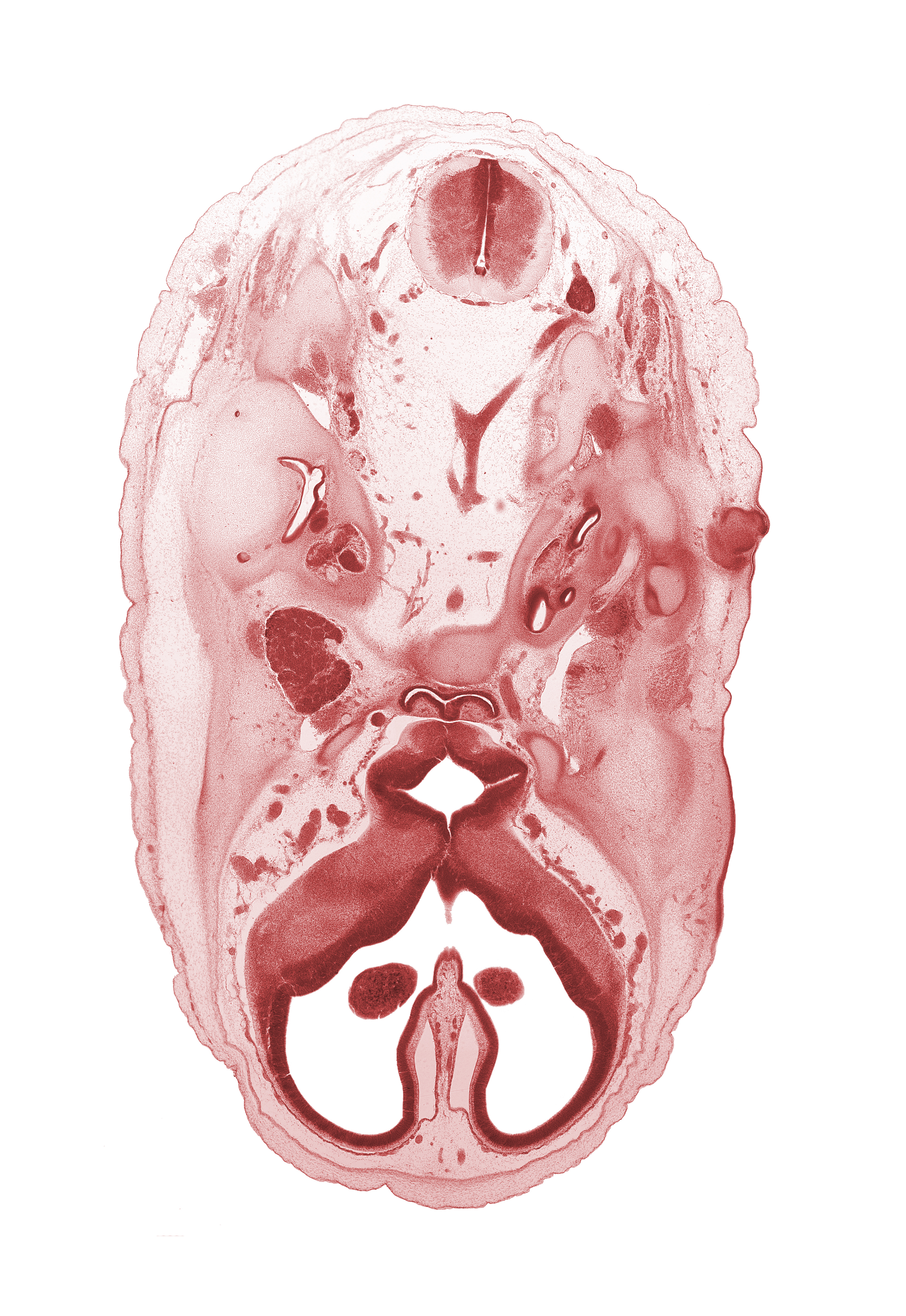 C-1 spinal ganglion, abducens nerve (CN VI), adenohypophysis, anterior cerebral artery, artifact separation(s), basi-occipital (basal plate), basilar artery, central canal, cerebral vesicle (telencephalon), dorsal funiculus, facial nerve (CN VII), hypoglossal nerve (CN XII), interventricular foramen, junction of vertebral arteries, lateral funiculus, lateral ventricle, mandibular nerve (CN V₃), maxillary nerve (CN V₂), medial ventricular eminence (diencephalon), ophthalmic nerve (CN V₁), optic canal, orbitosphenoid, spinal accessory nerve (CN XI), third ventricle, tip of cochlear duct, vagus nerve (CN X), ventral funiculus, vertebral artery