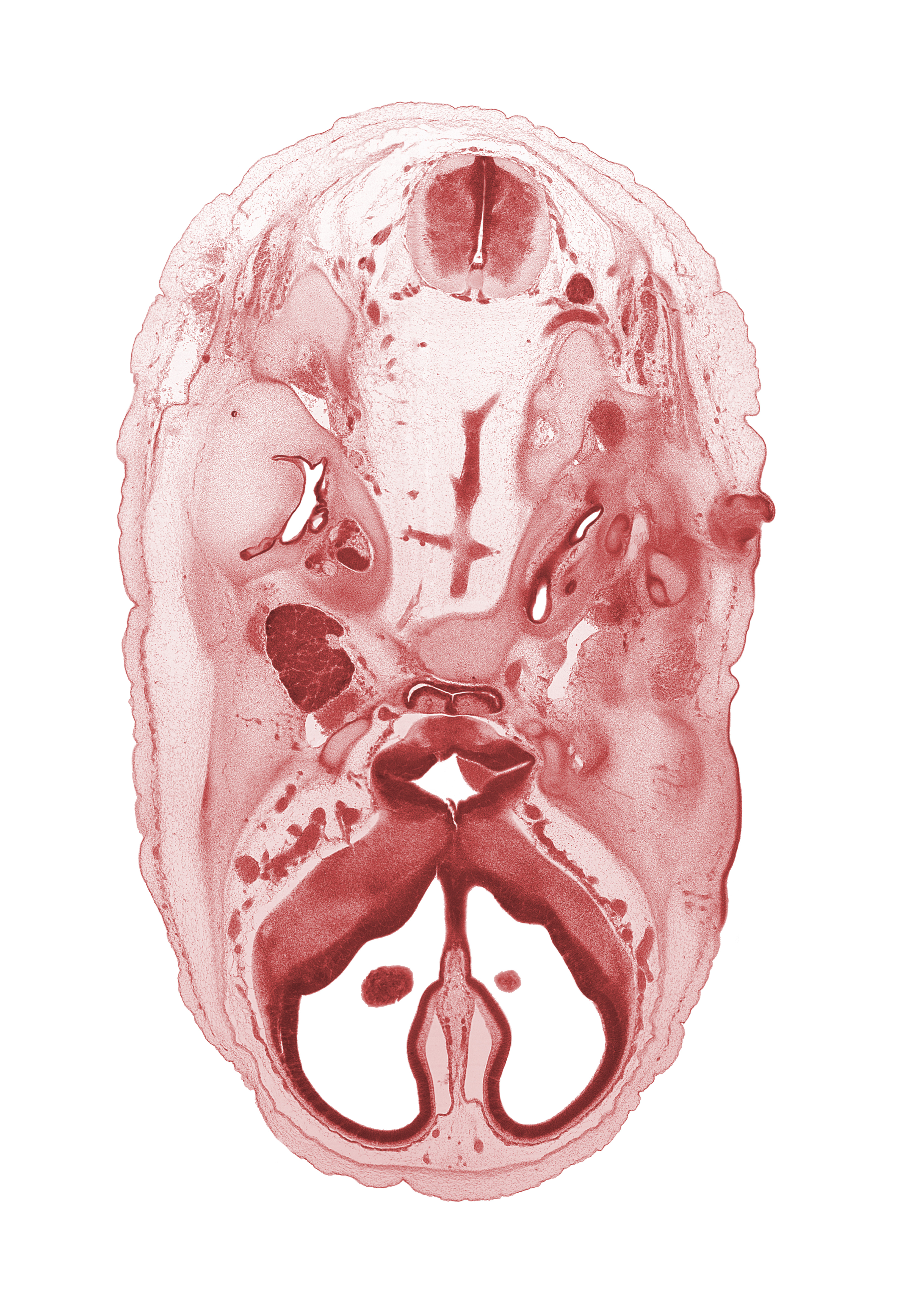 C-1 spinal ganglion, abducens nerve (CN VI), accessory nerve (CN XI), basilar artery, cochlear duct, distal part of adenohypophysis, edge of choroid plexus, falx cerebri region, geniculate ganglion (CN VII), glossopharyngeal nerve (CN IX), grey matter, horizontal part of facial nerve (CN VII), internal carotid artery, internal jugular vein, mandibular nerve (CN V₃), medial ventricular eminence (diencephalon), optic canal, optic chiasma (chiasmatic plate), optic groove, orbitosphenoid, otic capsule, vagus nerve (CN X), vertebral artery, white matter