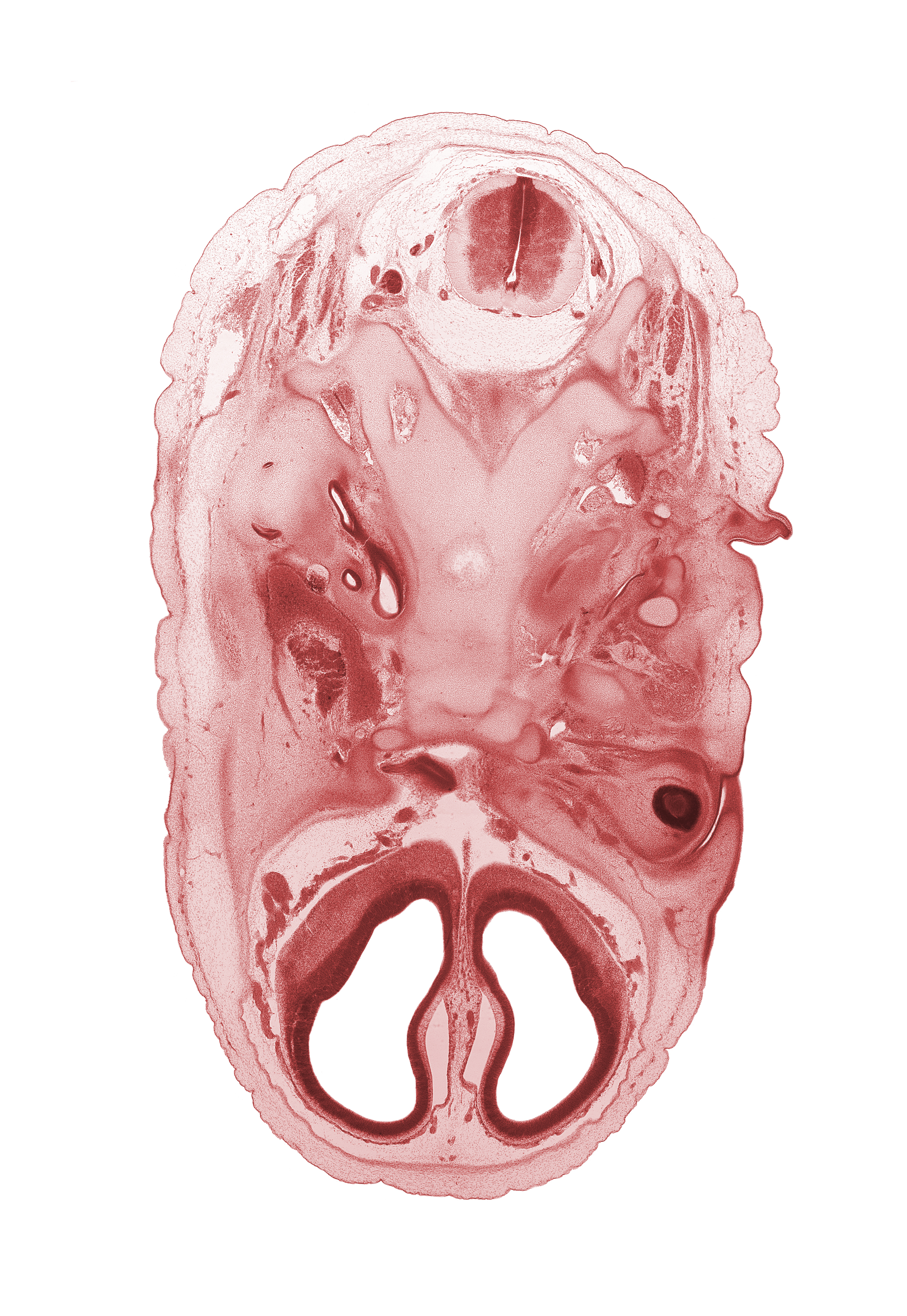 C-2 dorsal root, artifact separation(s), atlanto-occipital joint, basi-occipital (basal plate), blastema of medial rectus muscle, cephalic edge of C-2 spinal ganglion, cephalic edge of dens of C-2 vertebra (axis), cerebral vesicle (telencephalon), cochlear duct, edge of conjunctival sac, edge of cranial cavity, edge of diencephalon, edge of retina, glossopharyngeal nerve (CN IX), hypoglossal canal, lateral ventricle, maxillary vein, neural arch of C-1 vertebra (atlas), occipital condyle, orbitosphenoid, osteogenic layer, otic capsule, subarachnoid space, vagus nerve (CN X), vertebral artery