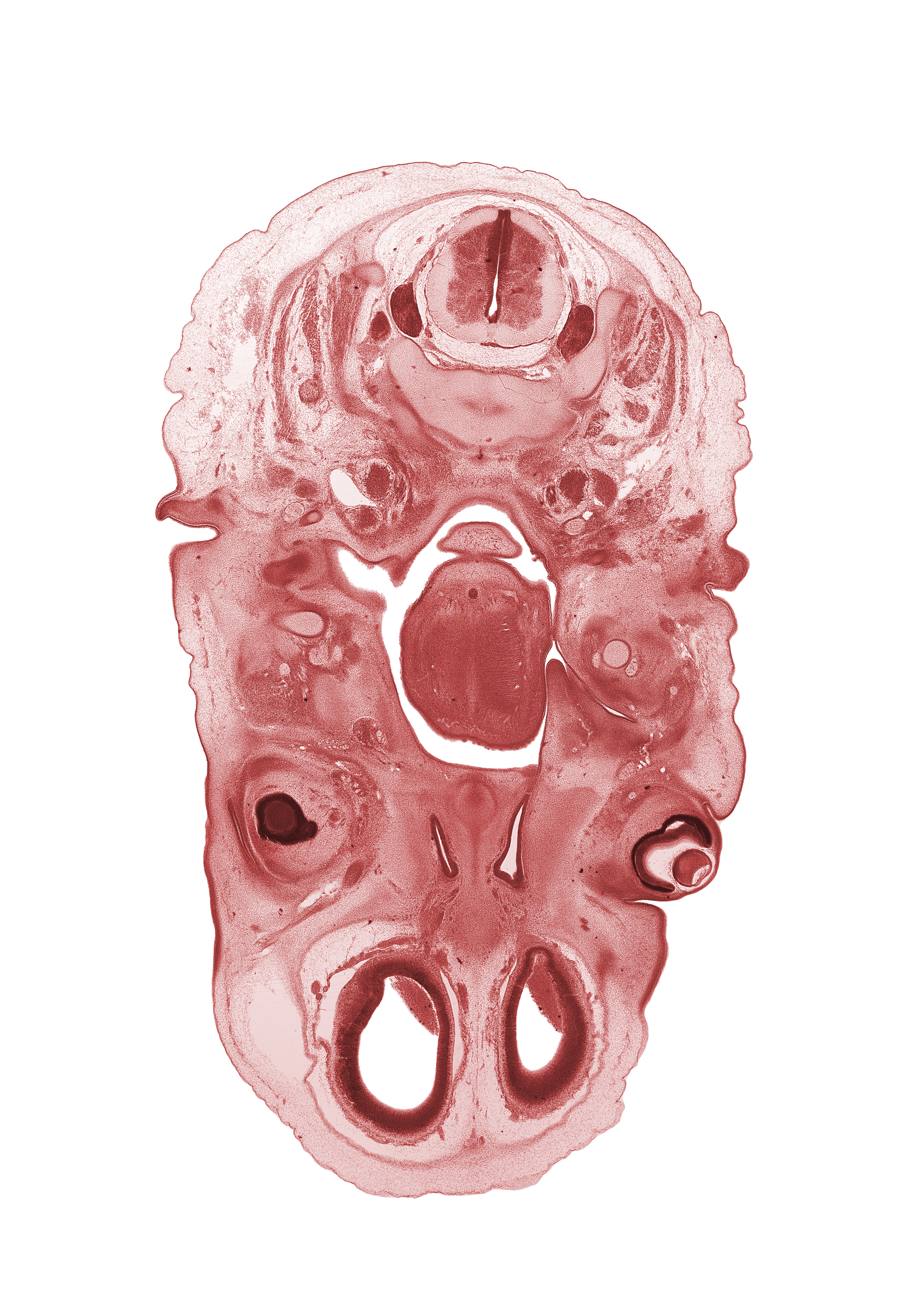 C-3 spinal ganglion, auricle, central canal, cerebral vesicle (telencephalon), ear ossicle, edge of nasal cavity (nasal sac), edge of retina, epiglottis, ethmoid condensation, external acoustic meatus, glossopharyngeal nerve (CN IX), internal jugular vein, intraretinal space (optic vesicle cavity), laryngeal pharynx, lateral ventricle, lens vesicle, nasal cavity (nasal sac), nasopharynx, neural arch of C-2 vertebra (axis), olfactory ventricle, optic cup cavity, pharyngeal arch 1 cartilage (Meckel), subarachnoid space, thyroglossal duct