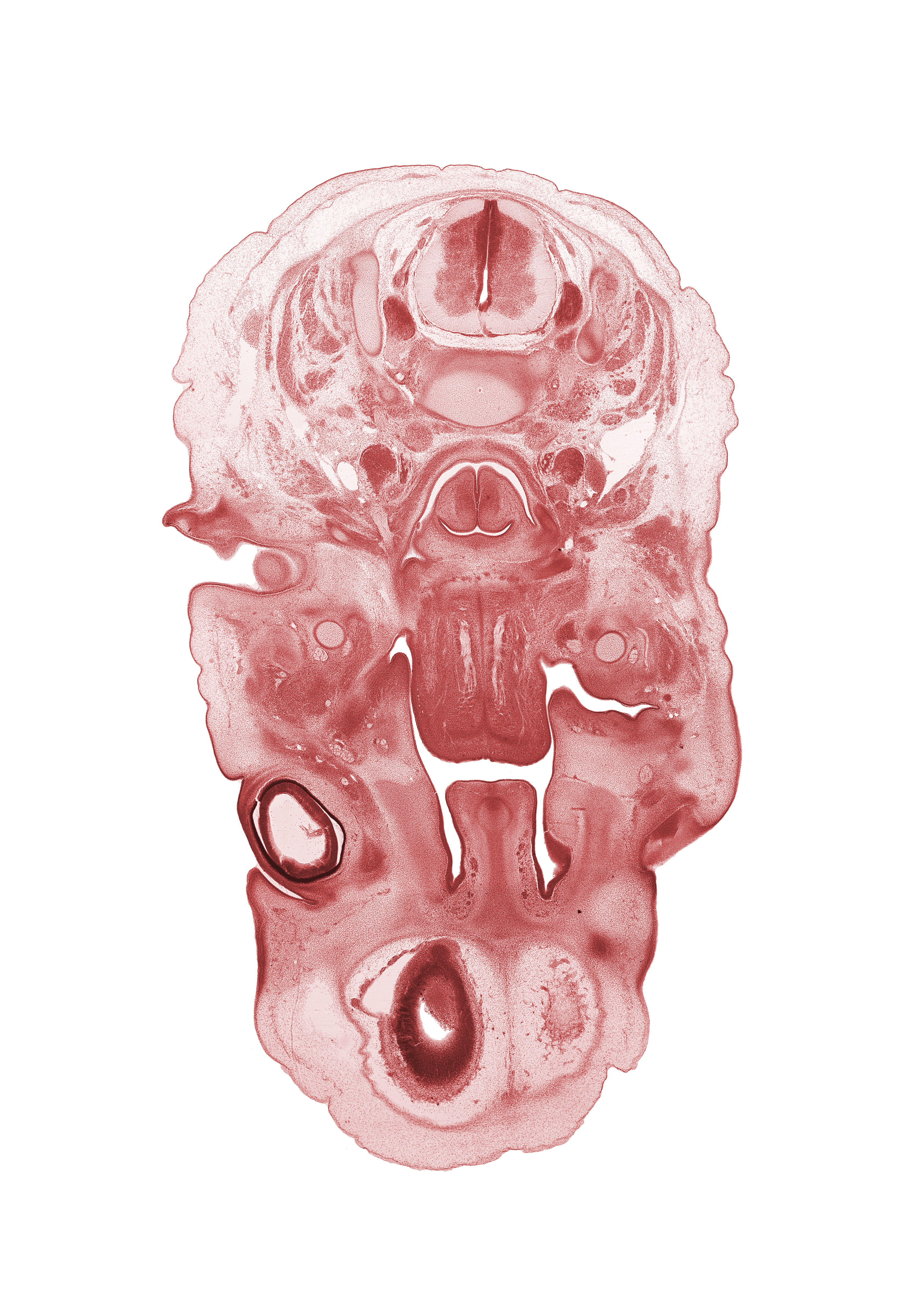 C-3 / C-4 intervertebral disc, C-4 spinal ganglion, auricle, blastema of extra-ocular muscle(s), edge of cerebral vesicle(s), edge of lateral ventricle, external acoustic meatus, frontal prominence, hypoglossal nerve (CN XII), inferior alveolar nerve, inferior ganglion of vagus nerve (CN X), infra-orbital nerve, intraretinal space (optic vesicle cavity), larynx, lingual nerve, nasal septum, optic cup cavity, semispinalis capitis muscle, semispinalis cervicis muscle, spinal accessory nerve (CN XI), splenius muscle, superior cervical sympathetic ganglion, trapezius muscle, vertebral artery