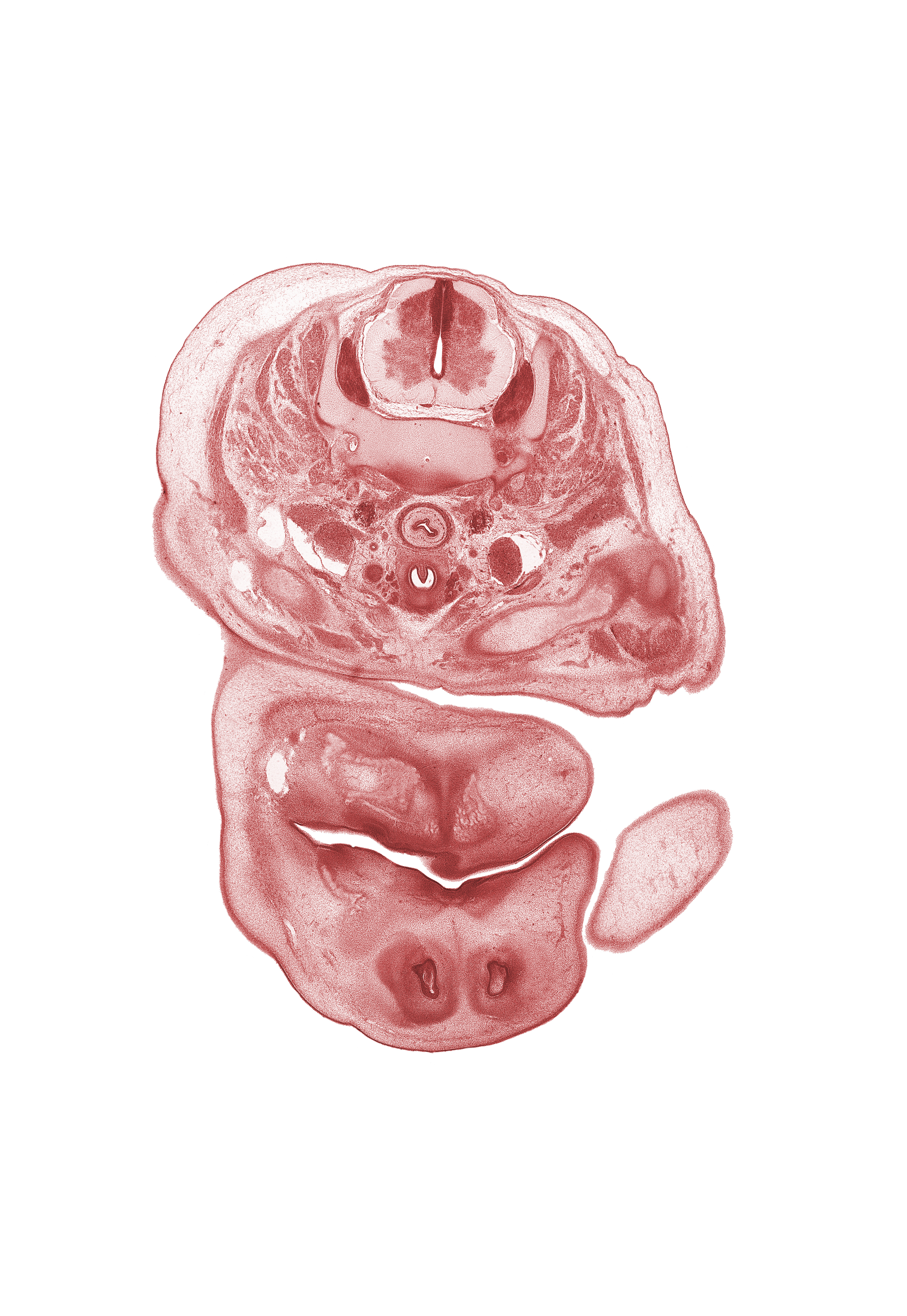 C-6 spinal ganglion, blastema of facial muscle, central canal, dorsal horn of grey matter, epithelial plug in naris, inferior ganglion of vagus nerve (CN X), inferior parathyroid gland, internal carotid artery, internal jugular vein, jugular lymph sac, nose, oral fissure, platysma muscle, primary palate, scapula, subarachnoid space, sympathetic trunk, thyroid gland, trachea, upper limb, ventral horn of grey matter