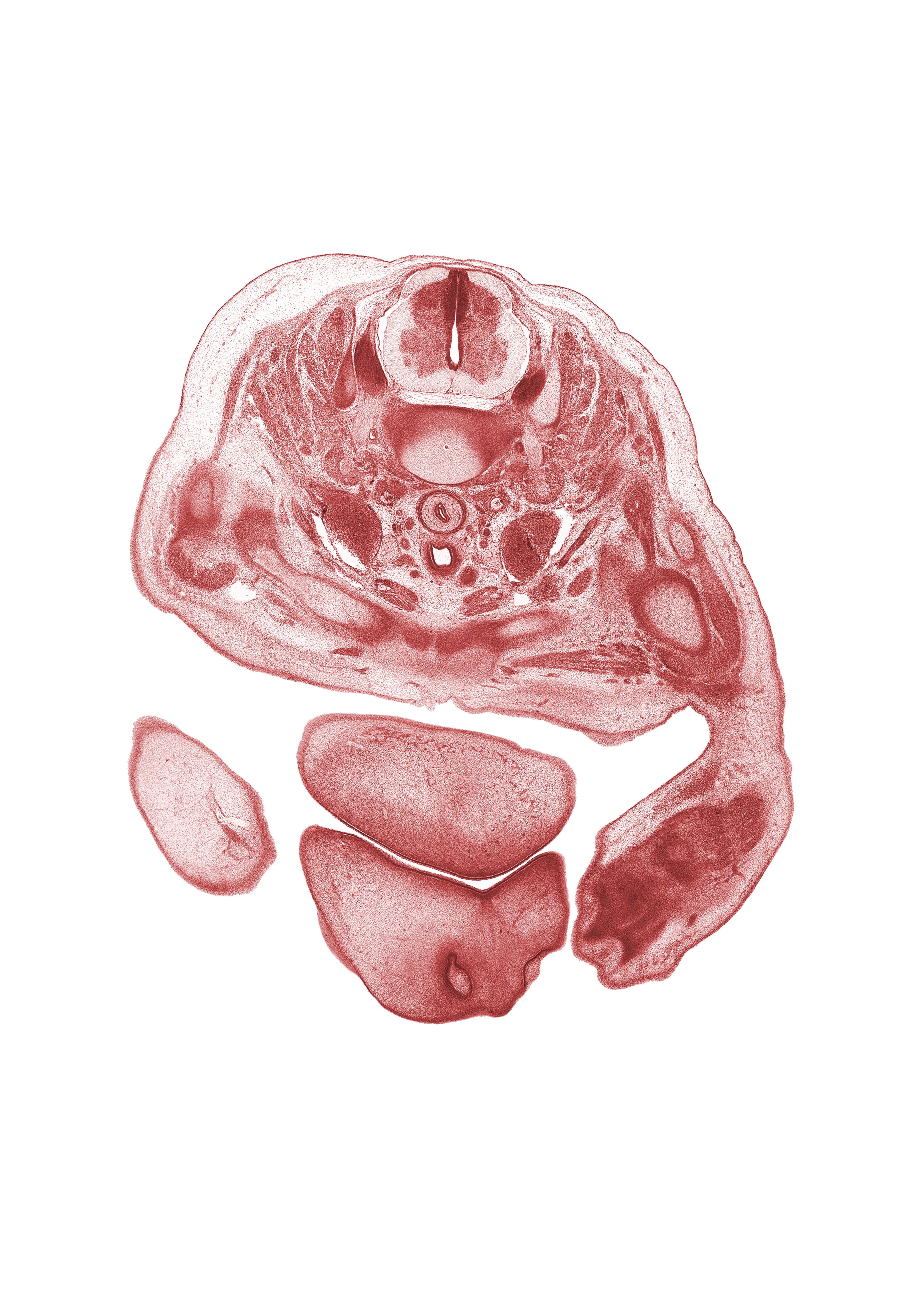 C-5 / C-6 intervertebral disc, C-6 spinal ganglion, C-6 spinal nerve, blastemata of extensor muscles in forearm, central canal, chin, clavicle, dorsal funiculus, dorsum of hand, edge of left naris, epithelial plug in right naris, humerus, internal jugular vein, lateral funiculus, left lobe of thymus gland, oral fissure, right lobe of thymus gland, trachea, upper limb, vagus nerve (CN X), ventral funiculus