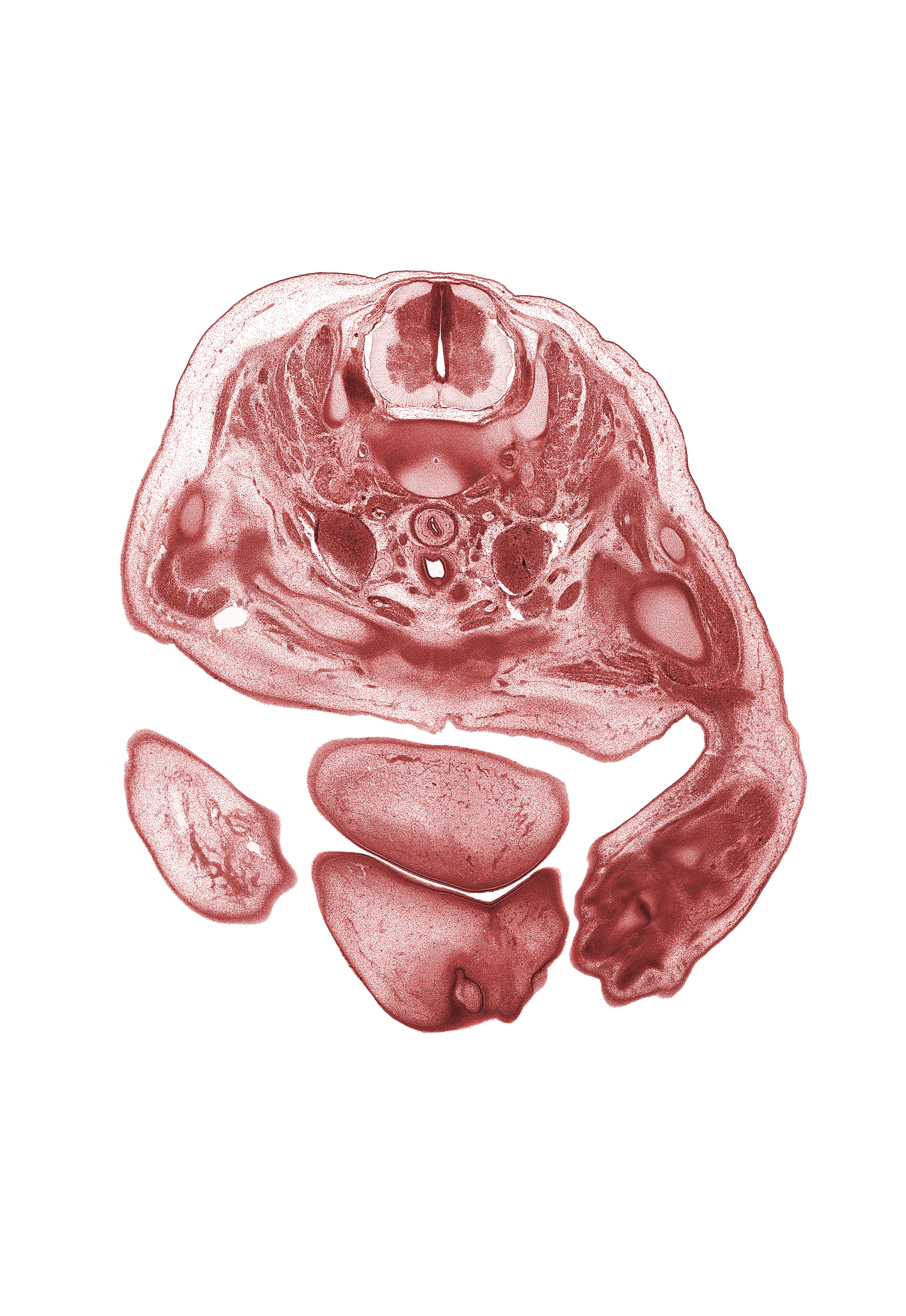 C-7 spinal ganglion, bifurcation of common carotid artery, chin, clavicle, dorsum of hand, edge of radius, epithelial plug in naris, internal jugular vein, jugular lymph sac, left lobe of thymus gland, muscular layer of esophagus, neck of humerus, notochord, primary palate, right subclavian artery, subarachnoid space, trachea, upper limb, upper lip