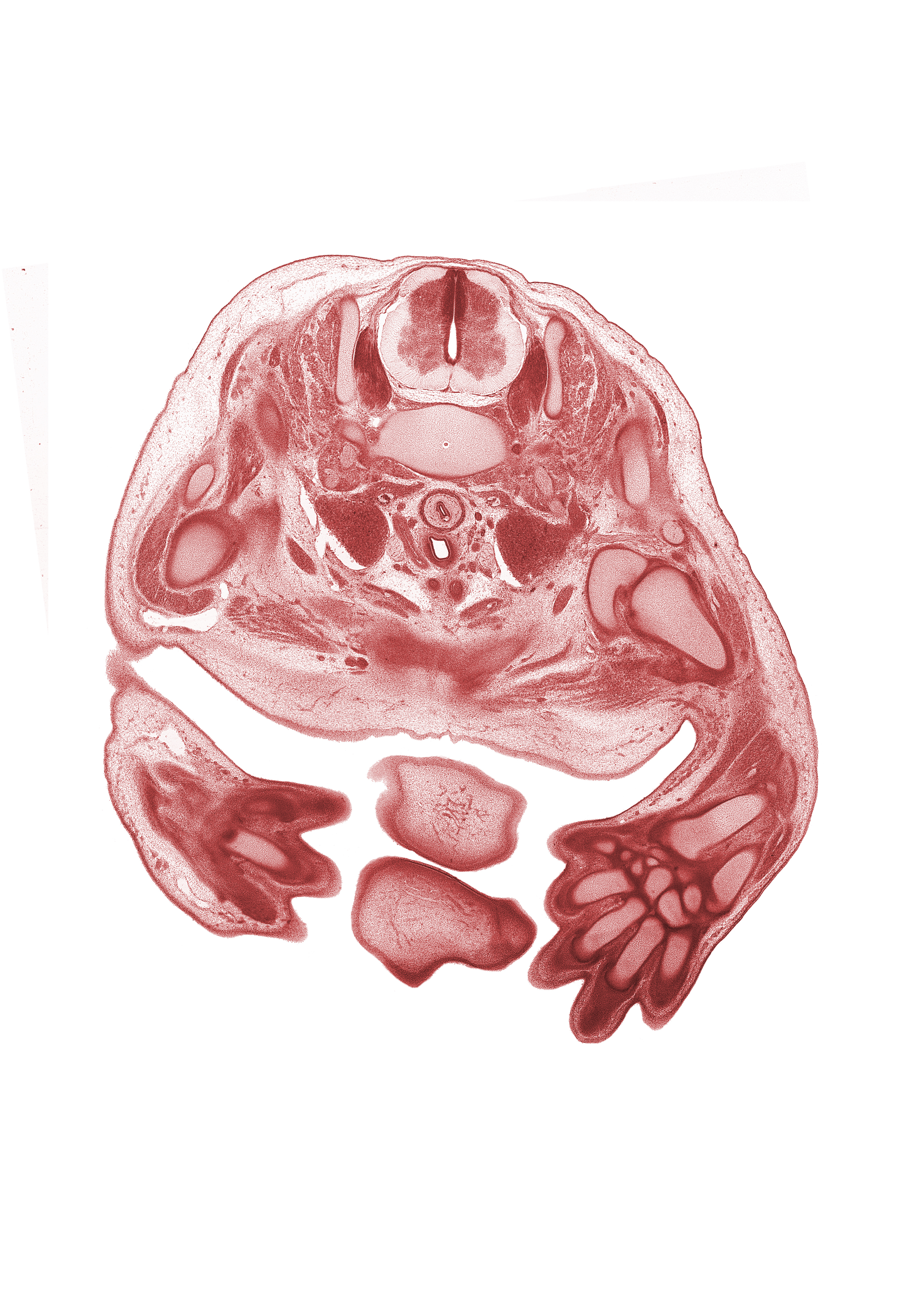 C-7 spinal ganglion, anterior scalene muscle, blastemata of strap muscles of neck, brachial plexus, brachiocephalic artery, capitate, cephalic vein, chin, forearm, hamate, head of humerus, intermediate zone, internal jugular vein, left lobe of thymus gland, marginal zone, medial pectoral nerve, metacarpal 3, middle scalene muscle, nose, pectoralis minor muscle, radius, trapezoid, triquetrum, ulna, ventricular zone