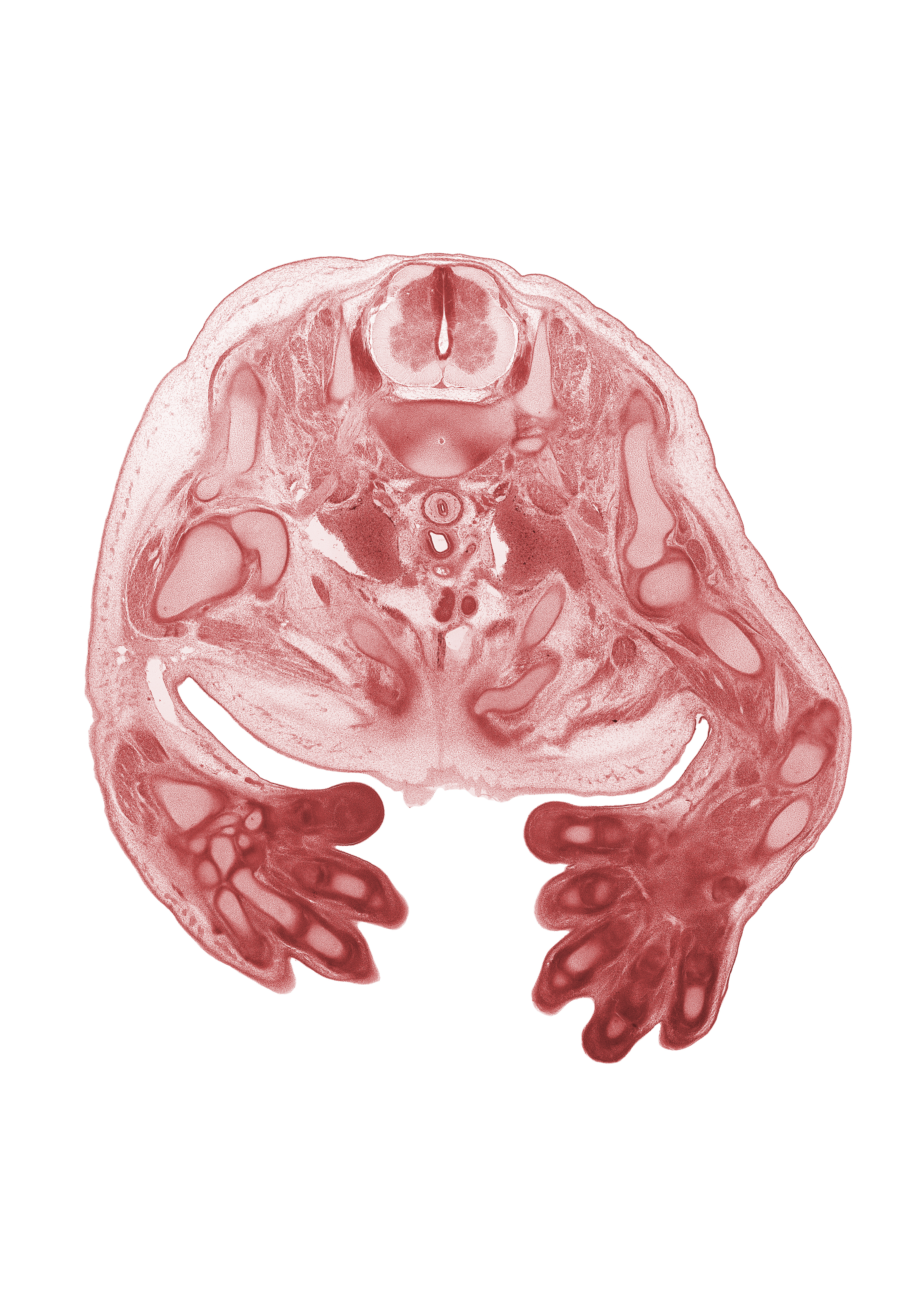 C-8 spinal ganglion, blastemata of extensor muscle(s), brachial plexus, brachiocephalic artery, cephalic edge of pericardial cavity, coracoid process of scapula, digit 5 (little finger), esophagus, internal jugular vein, lateral pectoral nerve, left common carotid artery, levator scapulae muscle, metacarpophalangeal joint, musculocutaneous nerve, pectoralis minor muscle, radial nerve, radius, rib 1, rib 2, shaft of humerus, spine of scapula, sternum region, subclavian vein, trachea, ulna