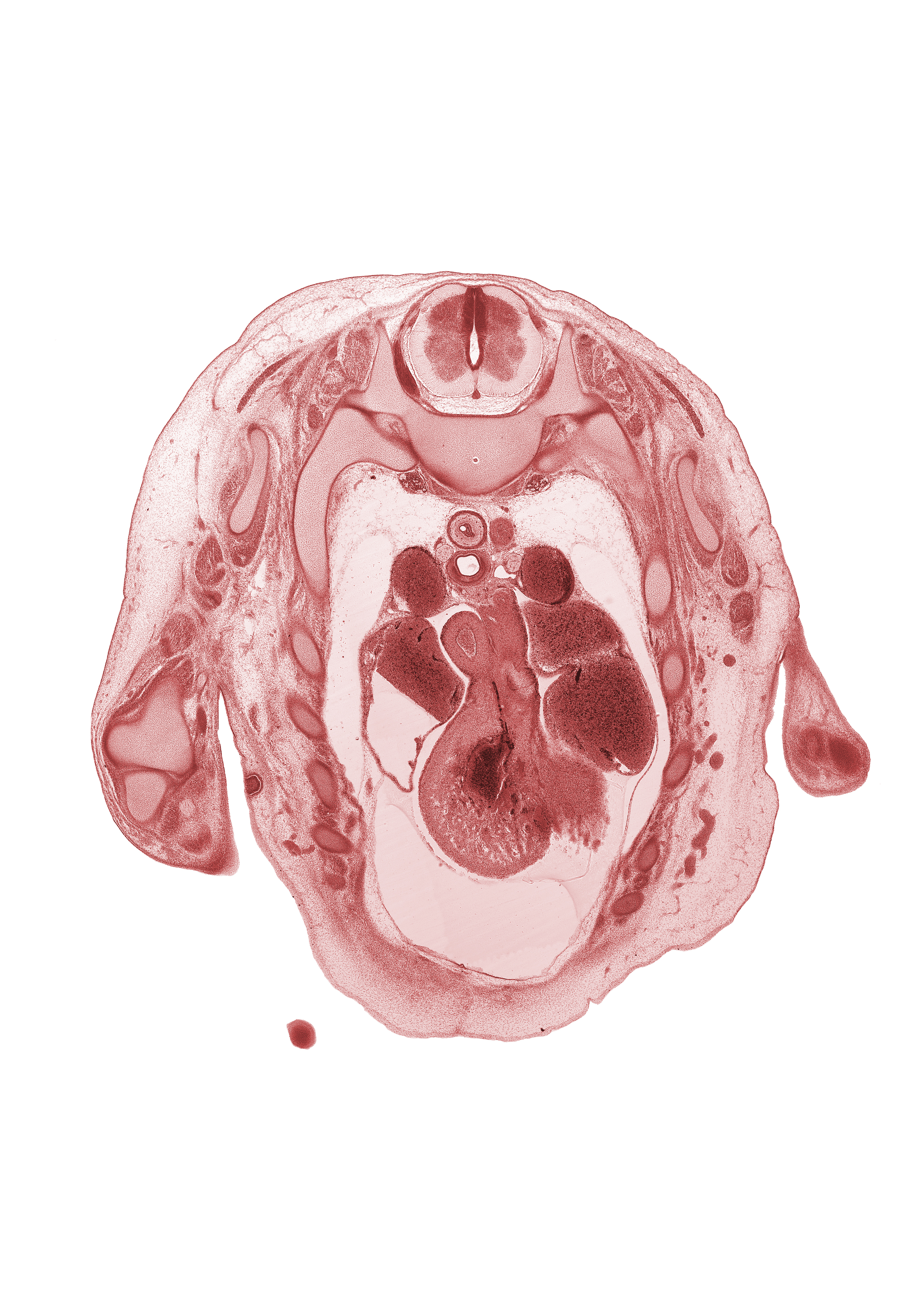 T-1 / T-2 interganglion region, T-1 dorsal root, anterior interventricular sulcus, ascending aorta, atrioventricular sulcus, caudal edge of hand, left atrium, musculi pectinati in wall of right auricle, notochord, pericardial cavity, phrenic nerve, pulmonary trunk bifurcation, rhomboid major muscle, rib 2, rib 3, superior vena cava, trapezius muscle