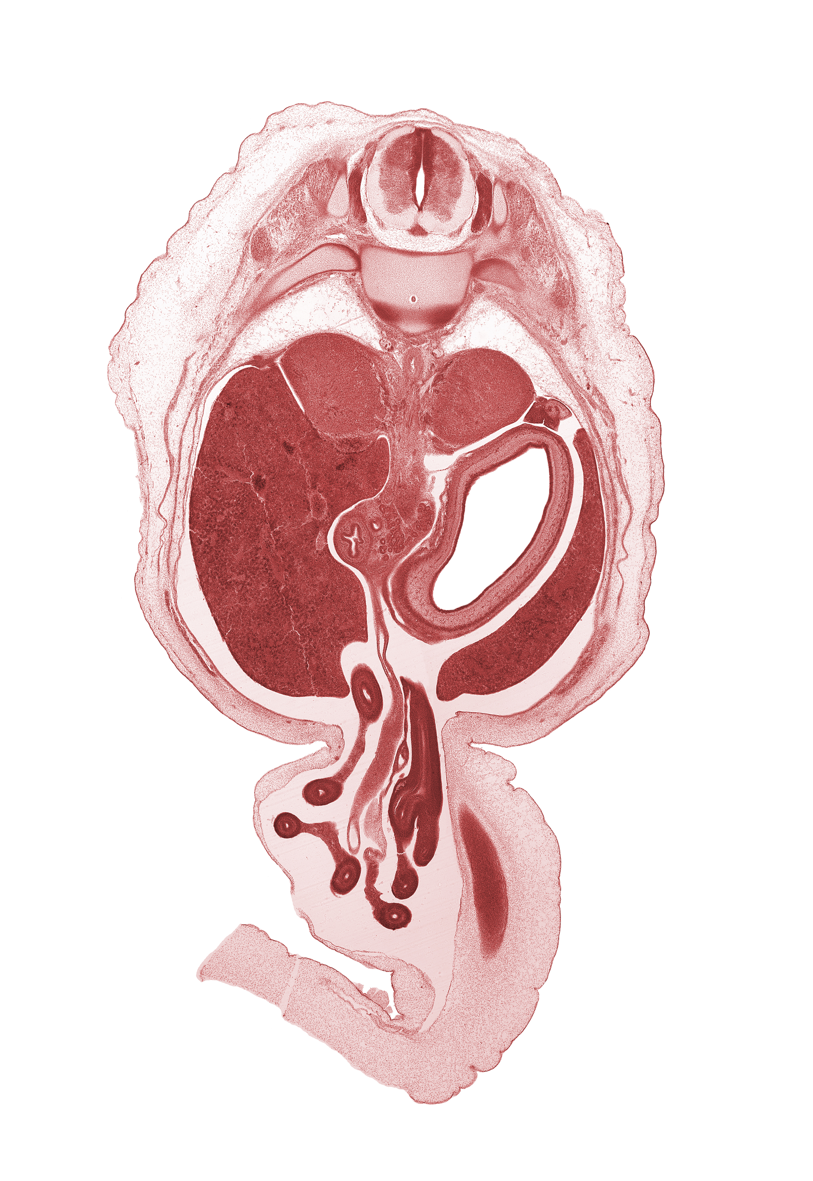 T-11 / T-12 intervertebral disc, T-11 rib head, T-11 spinal ganglion, aorta, bile duct, body of stomach, descending part of duodenum (second part), distal limb of herniated midgut, jejunum, junction of omphaloenteric and superior mesenteric arteries, latissimus dorsi muscle, left lobe of liver, proximal limb of herniated midgut, superior mesenteric artery, suprarenal gland cortex, suprarenal gland medulla, testis, umbilical vein