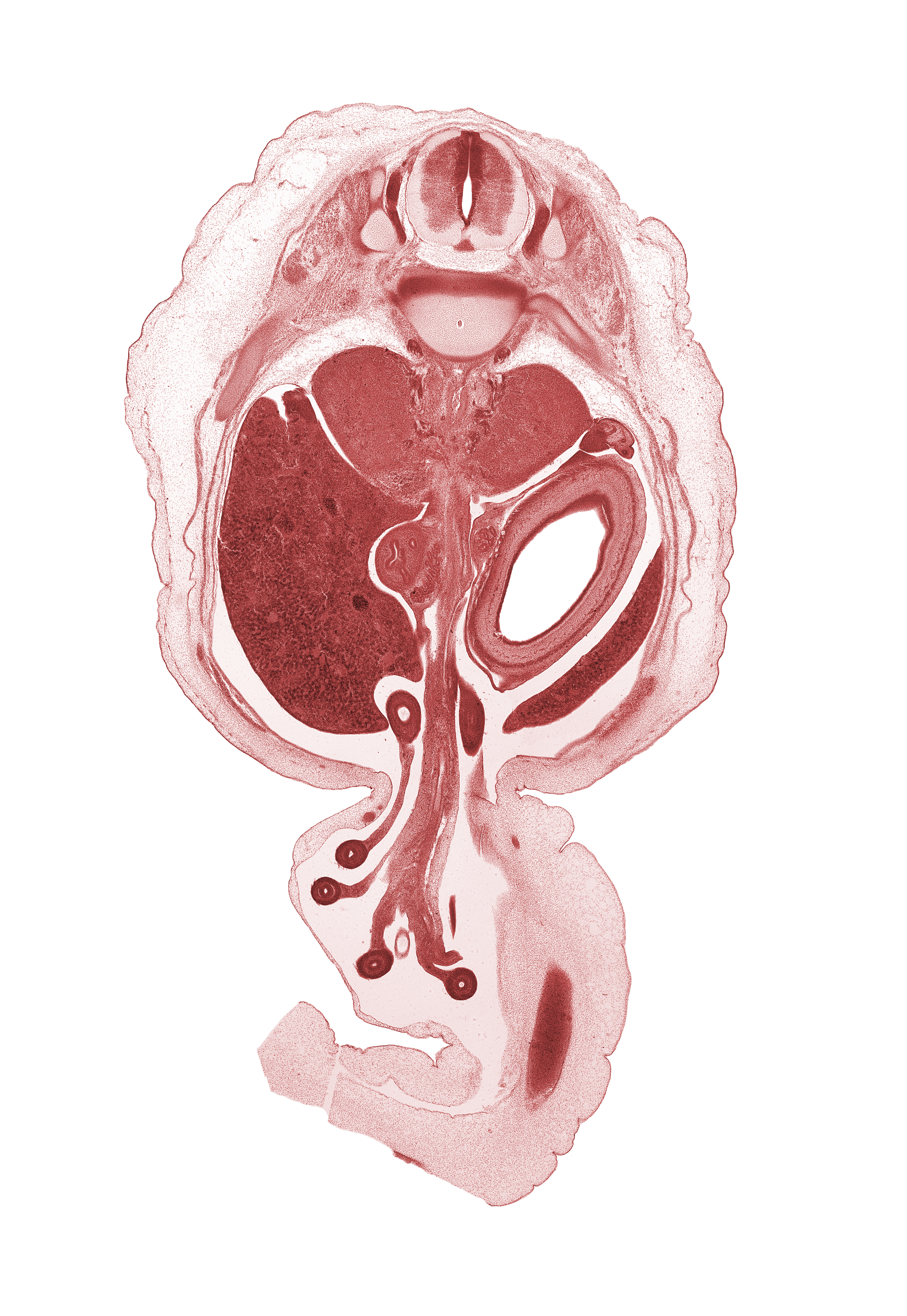 T-11 spinal nerve, T-12 spinal ganglion, allantois, aorta, body of dorsal pancreas, centrum of T-12 vertebra, descending part of duodenum (second part), distal limb of herniated midgut, hindgut (colon), jejunum, left lobe of liver, lumen of body of stomach, omphalomesenteric artery, peritoneal cavity, proximal limb of herniated midgut, rib 12, right lobe of liver, spleen, superior mesenteric artery, suprarenal gland cortex, umbilical coelom, umbilical vein