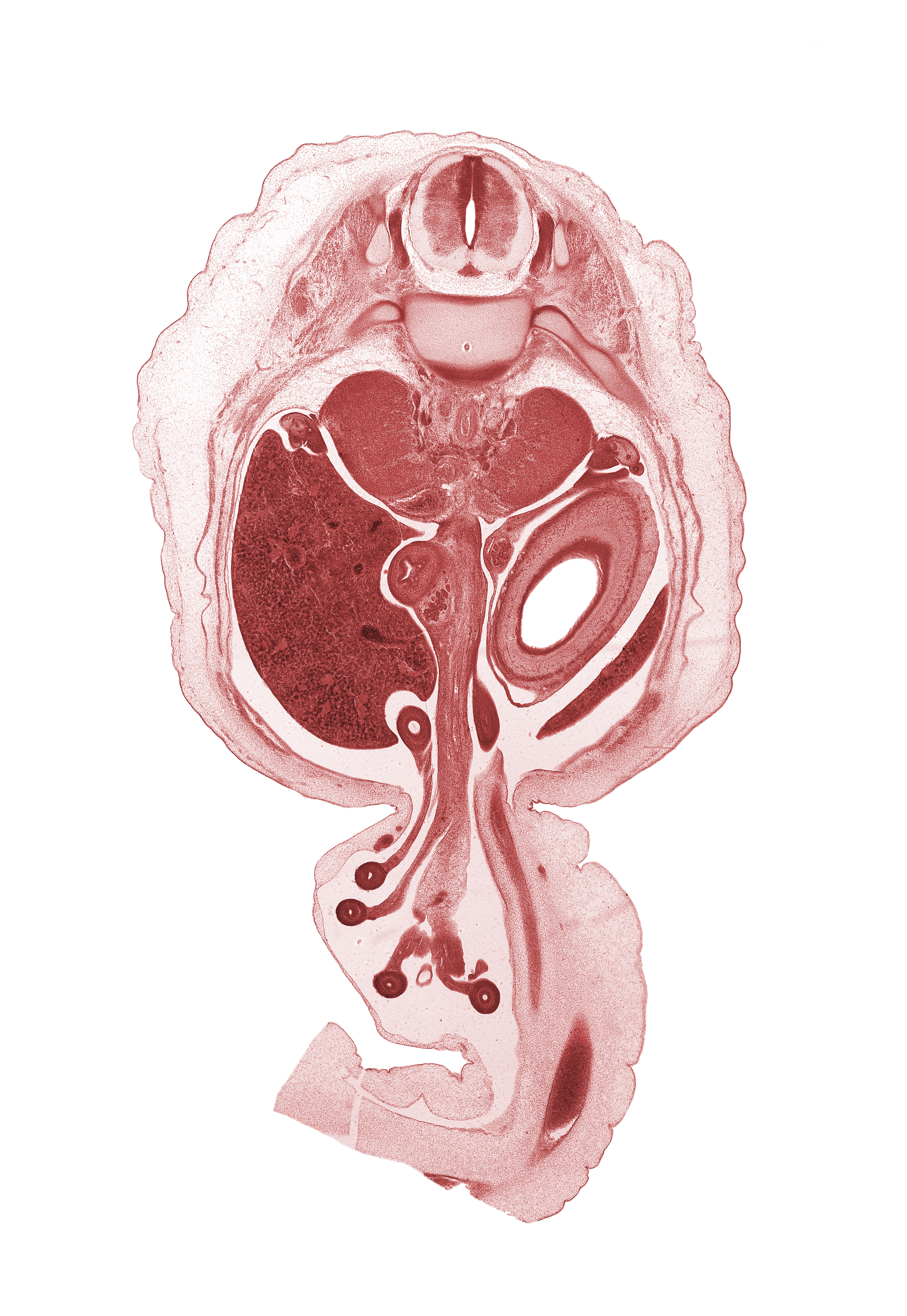 T-12 spinal ganglion, allantois, aorta, centrum of T-12 vertebra, descending part of duodenum (second part), distal limb of herniated midgut, dorsal mesogastrium, endoderm lining of stomach (mucosa), head of rib 12, head of ventral pancreas, hindgut (colon), jejunum, left umbilical artery, mesentery, muscularis of stomach, notochord, omphalomesenteric artery, proximal limb of herniated midgut, shaft of rib 12, spleen, superior mesenteric artery and vein, suprarenal gland cortex, testis, umbilical vein, vas deferens (mesonephric duct)
