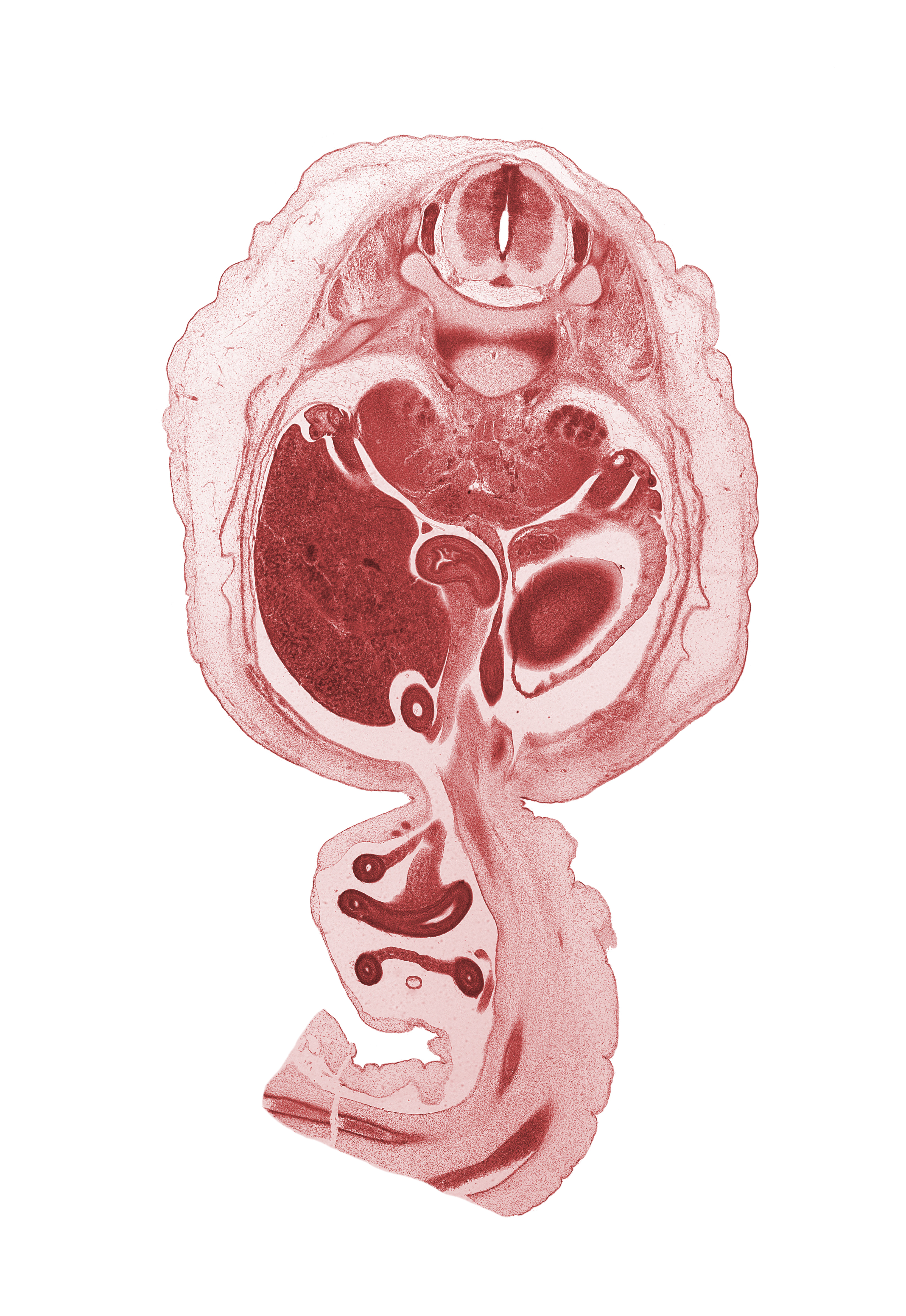 T-12 / L-1 intervertebral disc, T-12 spinal ganglion, T-12 spinal nerve, allantois, body of dorsal pancreas, centrum of L-1 vertebra, distal limb of herniated midgut, duodenum, external abdominal oblique muscle, hindgut (colon), internal abdominal oblique muscle, jejunum, left umbilical artery, mesentery, muscularis of stomach, omphalomesenteric artery, proximal limb of herniated midgut, rectus abdominis muscle, right umbilical artery, subcostal nerve (T-12 ventral primary ramus), superior pole of left kidney (metanephros), transversus abdominis muscle, umbilical vein, vas deferens (mesonephric duct)