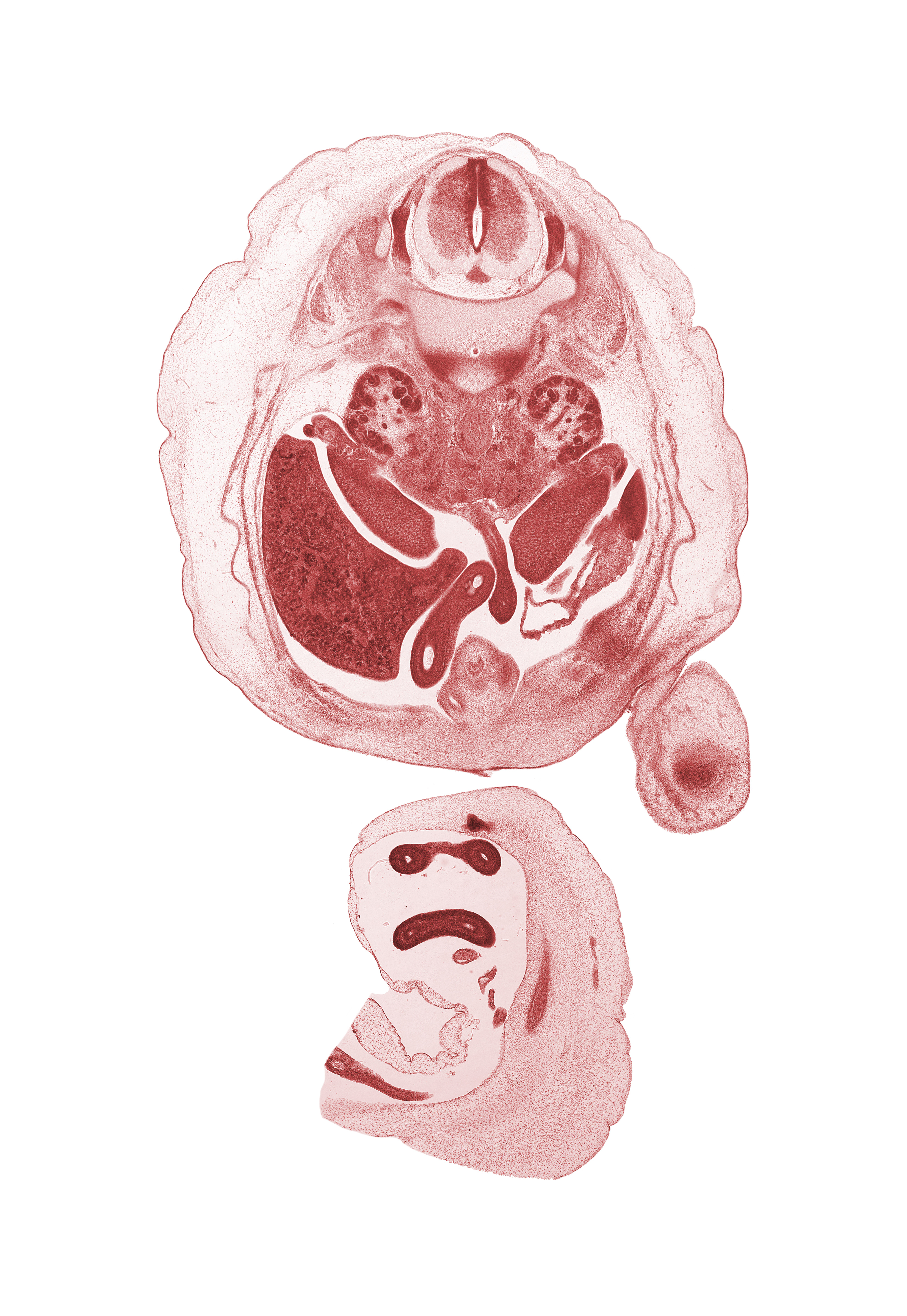 L-1 / L-2 intervertebral disc, L-1 spinal ganglion, aorta, apex of urinary bladder, central canal, duodenum, edge of femur, hilum of kidney (metanephros), hindgut (colon), inferior mesenteric artery, inferior mesenteric ganglion, jejunum, left umbilical artery, omphalomesenteric artery, proximal limb of herniated midgut, right lobe of liver, right umbilical artery, sartorius muscle, spleen, testis