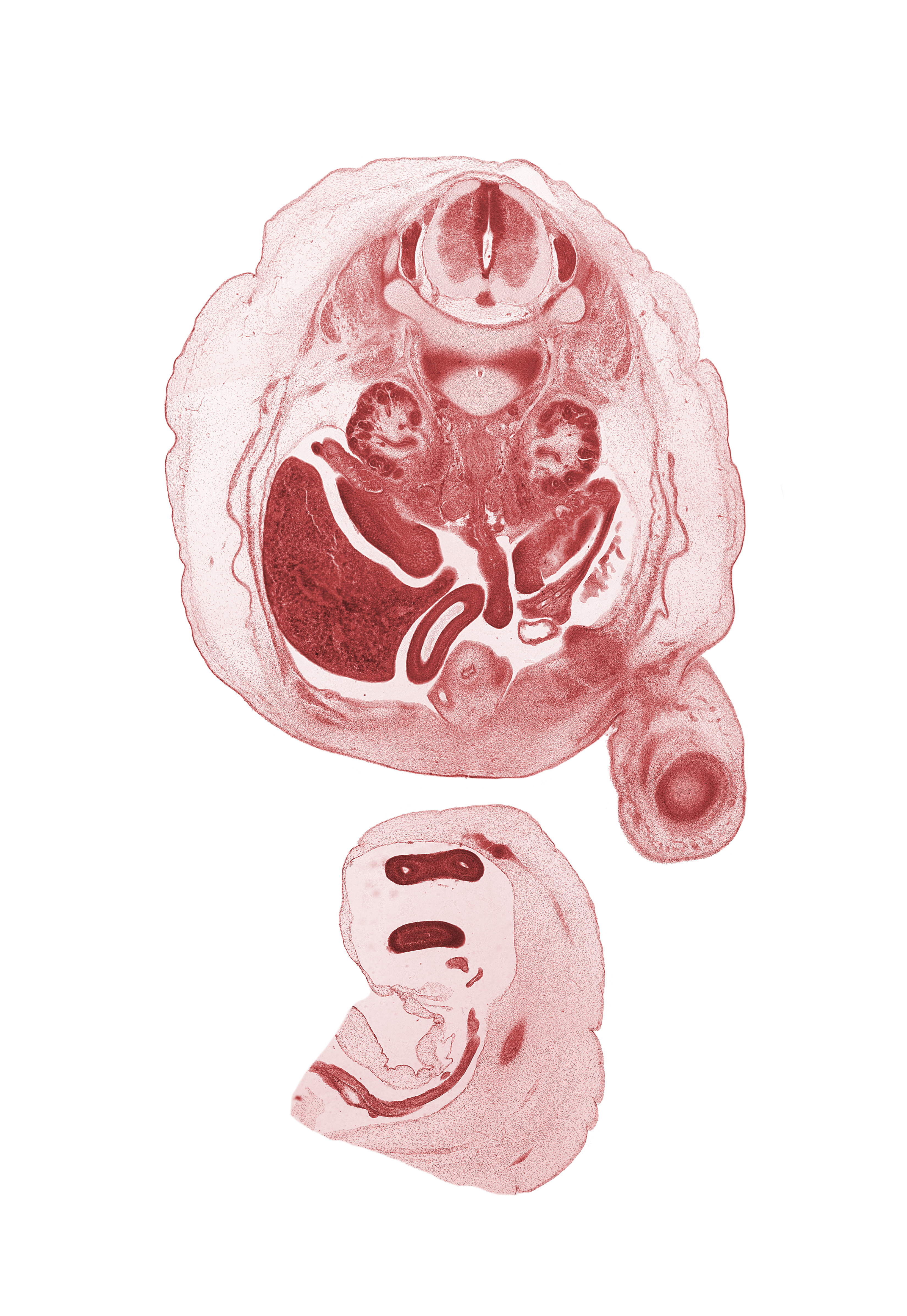 L-1 / L-2 intervertebral disc, L-1 spinal ganglion, L-1 spinal nerve, aorta, caudal edge of lesser sac (omental bursa), central canal, centrum of L-2 vertebra, femur, hindgut (colon), inferior vena cava (subcardinal vein), junction of duodenum and jejunum, notochord, omphalomesenteric artery, proximal limb of herniated midgut, right lobe of liver, right umbilical artery, testis, urinary bladder