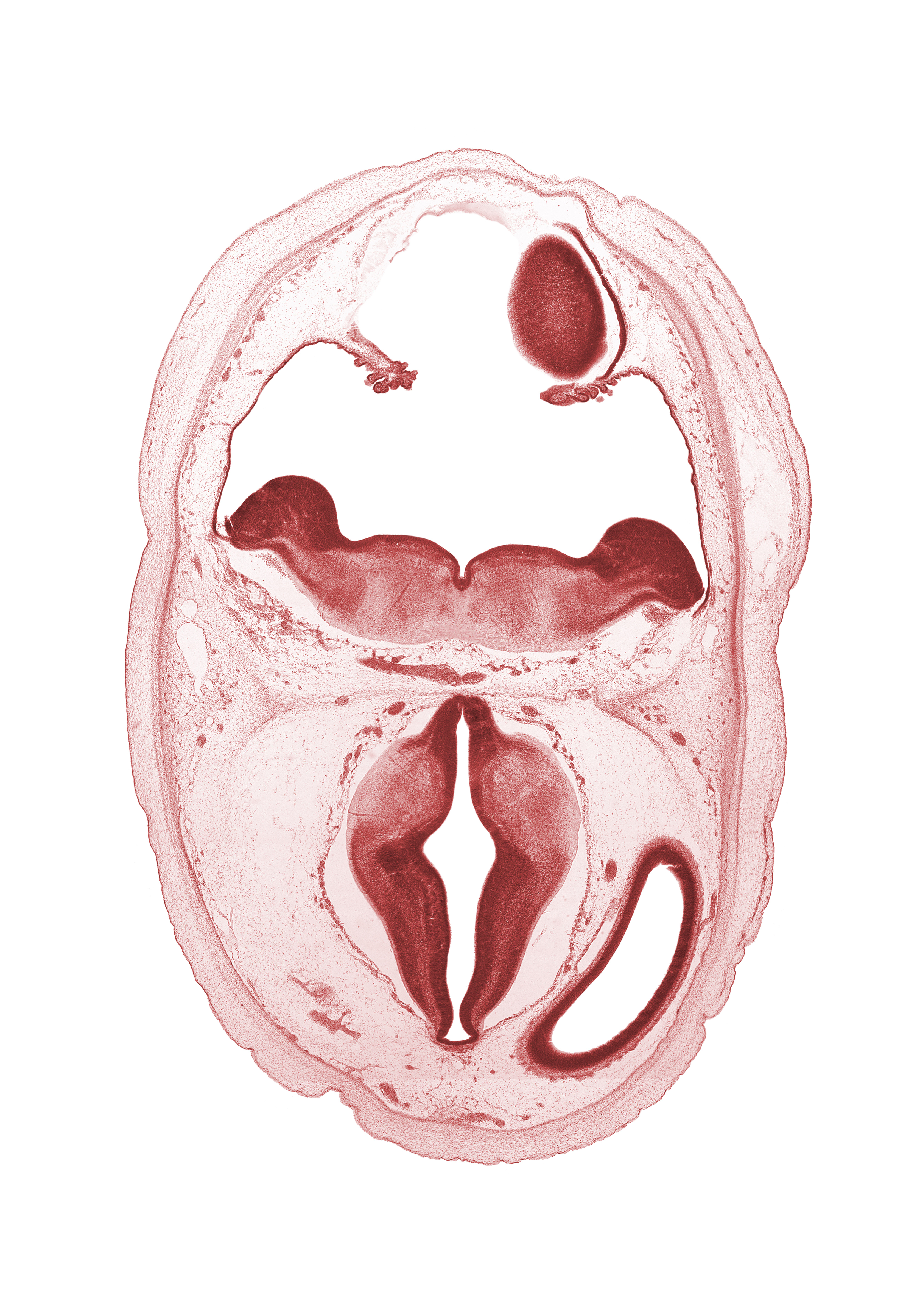 alar plate of metencephalon (cerebellum), alar plate of myelencephalon, basal plate, cerebral vesicle (telencephalon), diverticulum of rhombencoel (fourth ventricle), dorsal thalamus, hypothalamic sulcus, hypothalamus, lateral ventricle, median sulcus, oculomotor nerve (CN III), roof of rhombencoel (fourth ventricle), sulcus dorsalis, sulcus limitans, third ventricle, trochlear nerve (CN IV)