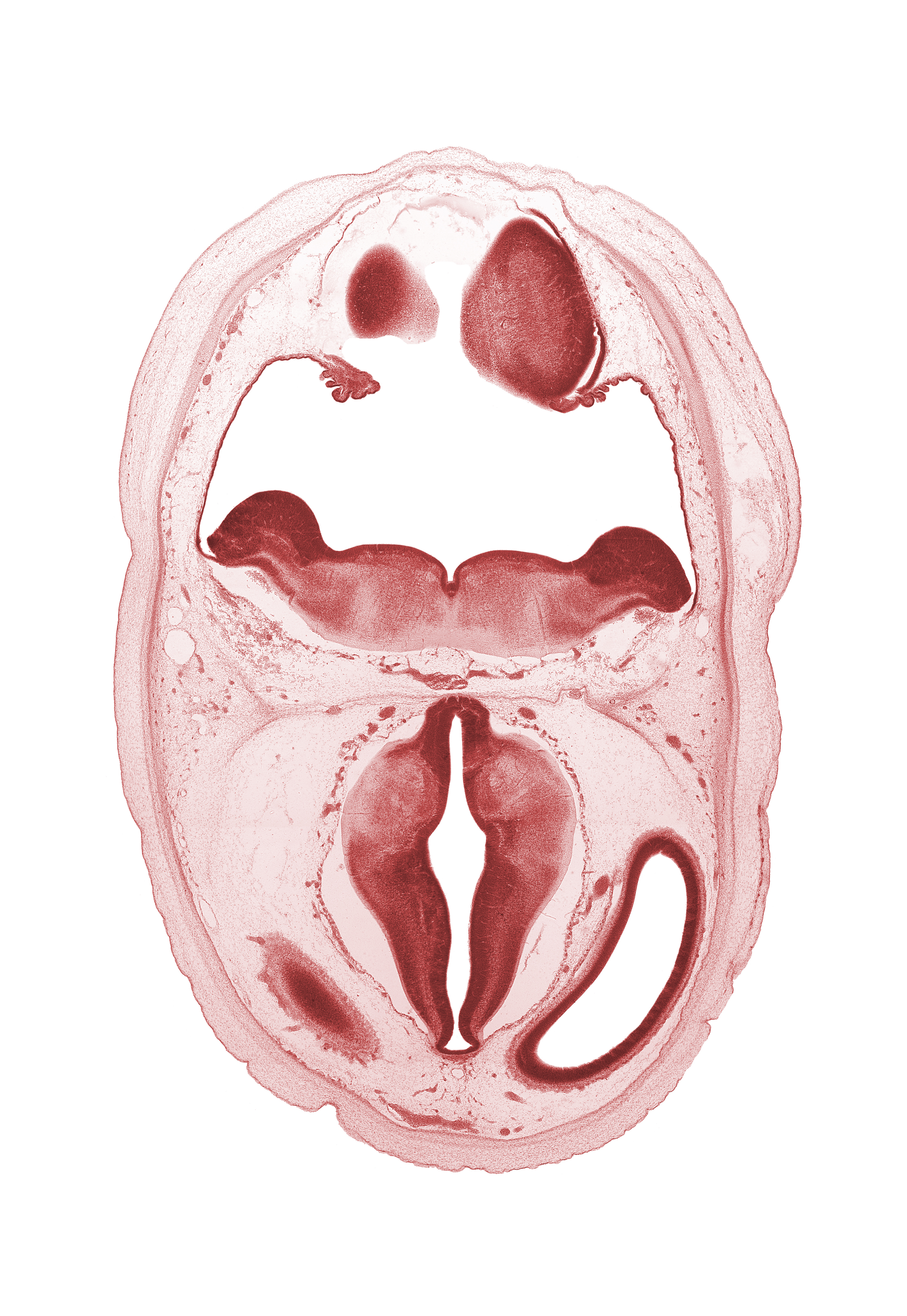 alar plate of myelencephalon, artifact separation(s), basilar artery, choroid plexus, dorsal thalamus, edge of cerebral vesicle(s), hypothalamic sulcus, hypothalamus, metencephalon, osteogenic layer, posterior communicating artery, rhombencoel (fourth ventricle), roof plate, surface ectoderm