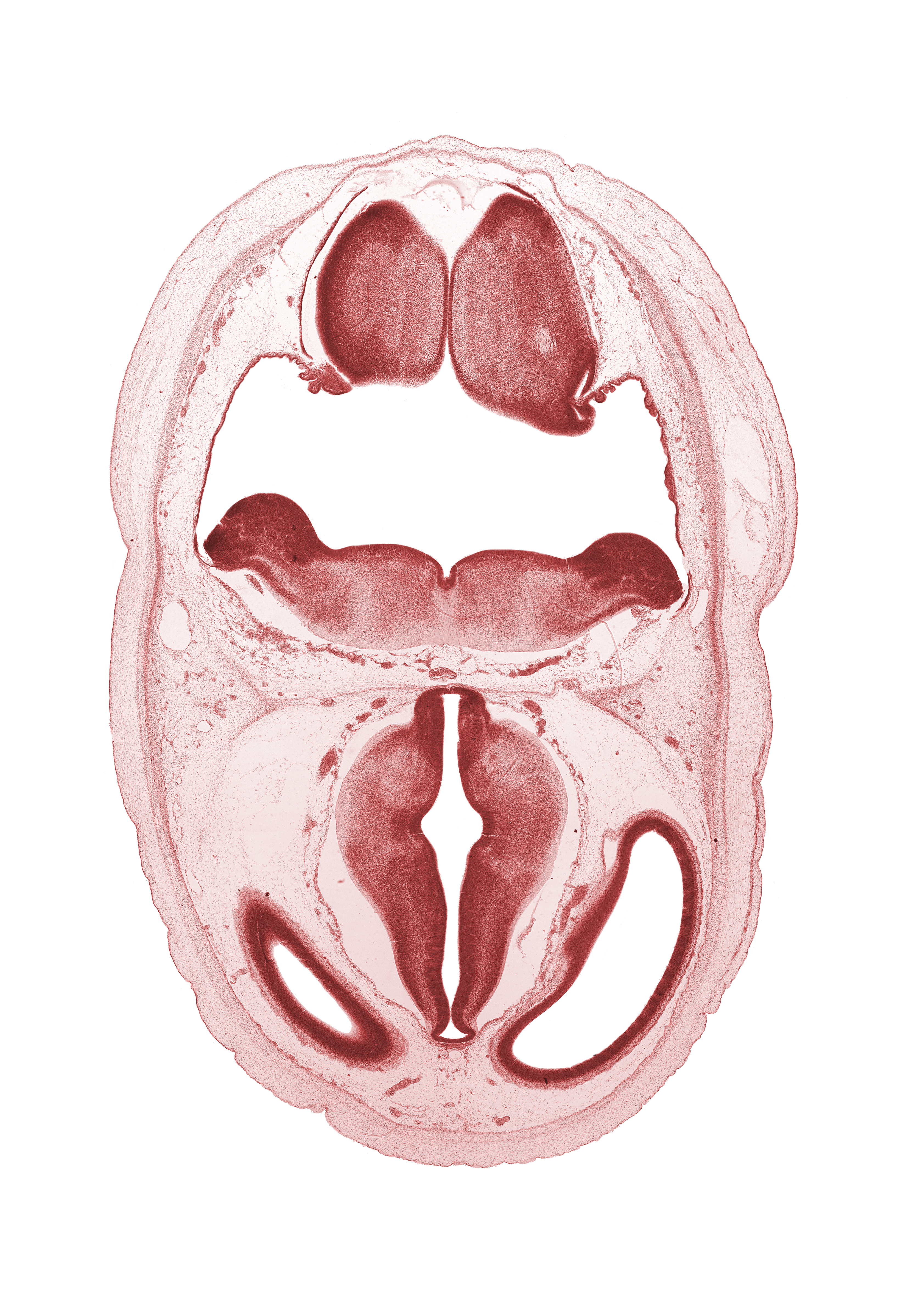 artifact separation(s), basilar artery, dural band for tentorium cerebelli, lateral ventricle, medial accessory olivary nucleus, oculomotor nerve (CN III), osteogenic layer, pons region (metencephalon), posterior communicating artery, rhombencoel (fourth ventricle), third ventricle, venous plexus(es)