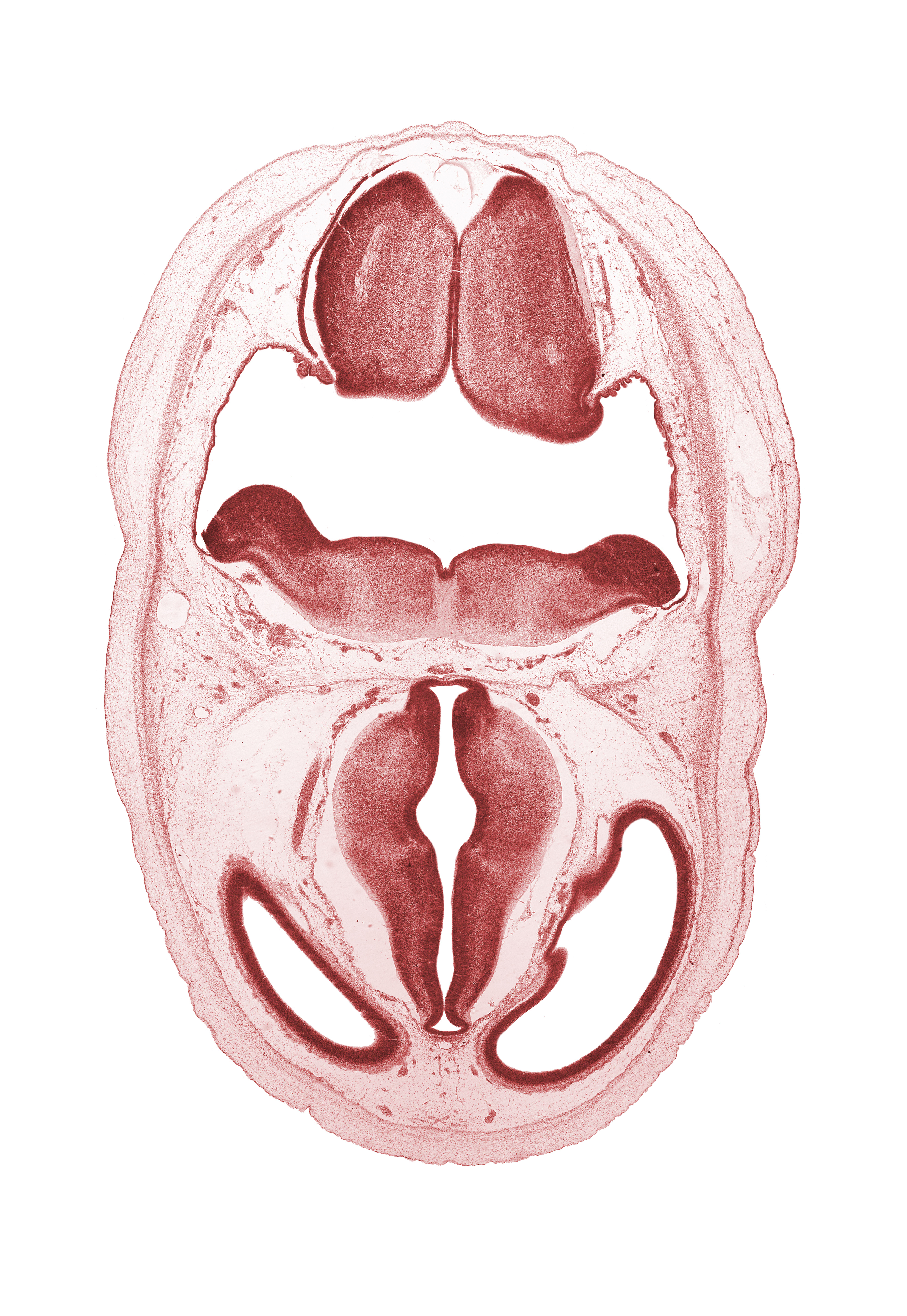 artifact separation(s), cerebral vesicle (telencephalon), dorsal thalamus, hypothalamic sulcus, lateral ventricle, loose connective tissue, myelencephalon (medulla oblongata), oculomotor nerve (CN III), osteogenic layer, posterior communicating artery, rhombencoel (fourth ventricle), subarachnoid space, sulcus dorsalis, surface ectoderm, ventral thalamus