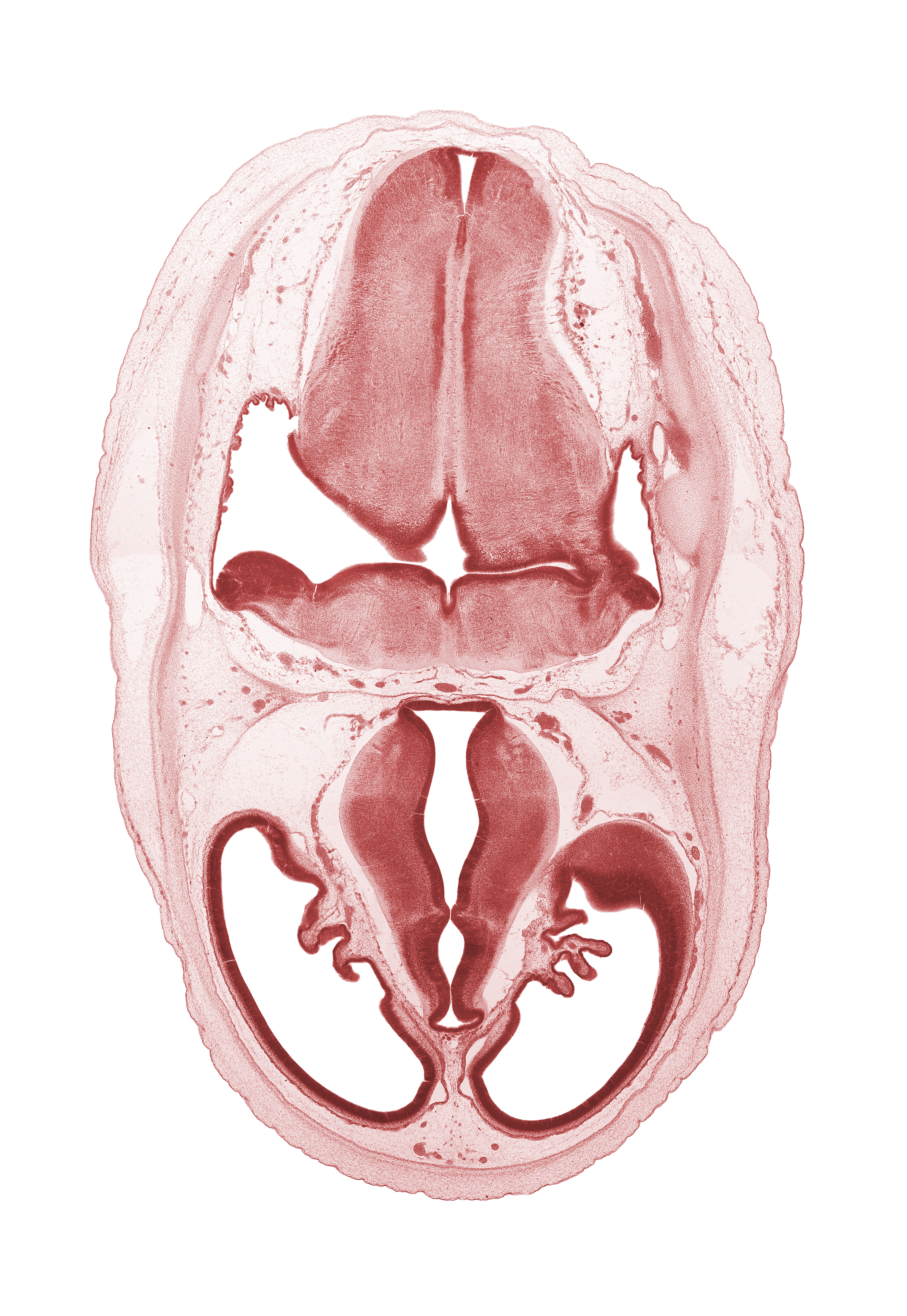 basilar artery, cerebral vesicle (telencephalon), diencephalon, dorsal thalamus, endolymphatic sac, lateral ventricle, marginal ridge, metencephalon (pons), myelencephalon (medulla oblongata), obex, posterior communicating artery, posterior dural venous plexus, rhombencoel (fourth ventricle), sulcus dorsalis, third ventricle, ventral thalamus, zona limitans intrathalamica