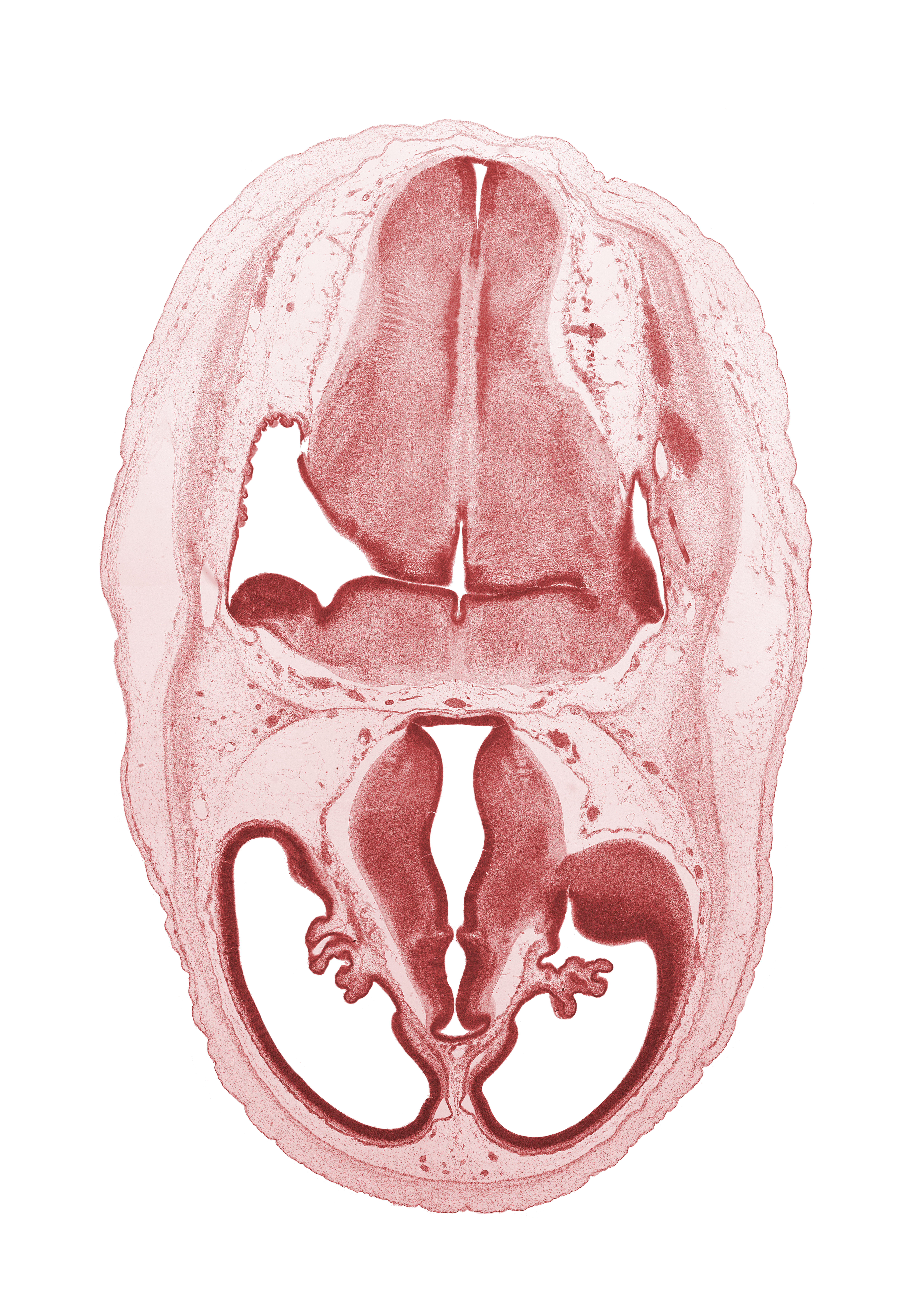 artifact separation(s), basilar artery, cerebral vesicle (telencephalon), choroid fissure, choroid plexus, dural band for tentorium cerebelli, hypothalamic sulcus, hypothalamus, lateral ventricle, marginal ridge, obex, oculomotor nerve (CN III), osteogenic layer, pons region (metencephalon), posterior dural venous plexus, primordial sigmoid sinus, venous plexus(es), ventral thalamus