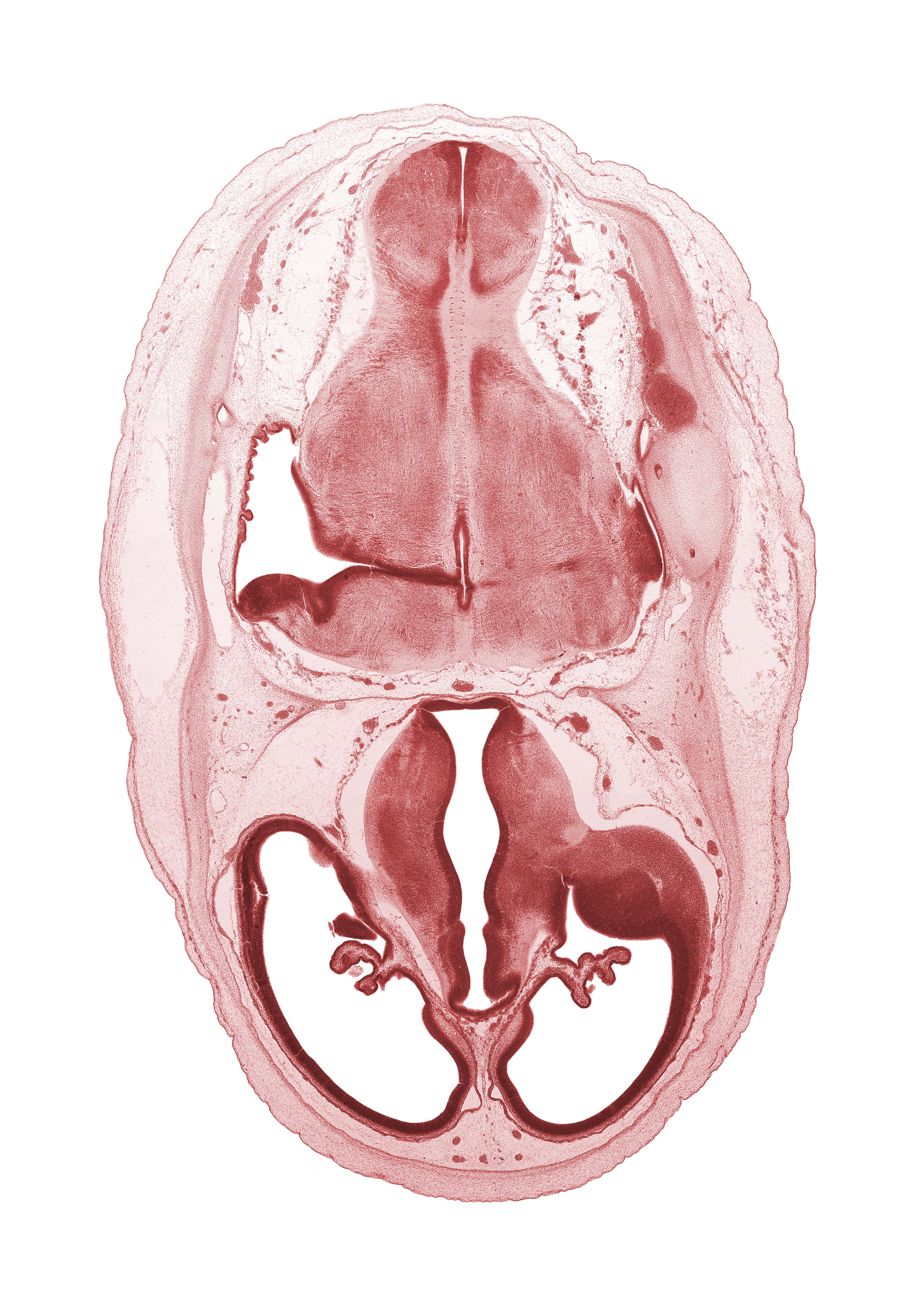 artifact separation(s), basilar artery, central canal, choroid plexus, dorsal thalamus, endolymphatic sac, falx cerebri region, hypothalamic sulcus, hypothalamus, lateral ventricle, marginal ridge, median sulcus, myelencephalon (medulla oblongata), osteogenic layer, posterior communicating artery, root of glossopharyngeal nerve (CN IX), stem of posterior dural venous plexus, sulcus dorsalis, sulcus medius, surface ectoderm, venous plexus(es), ventral thalamus