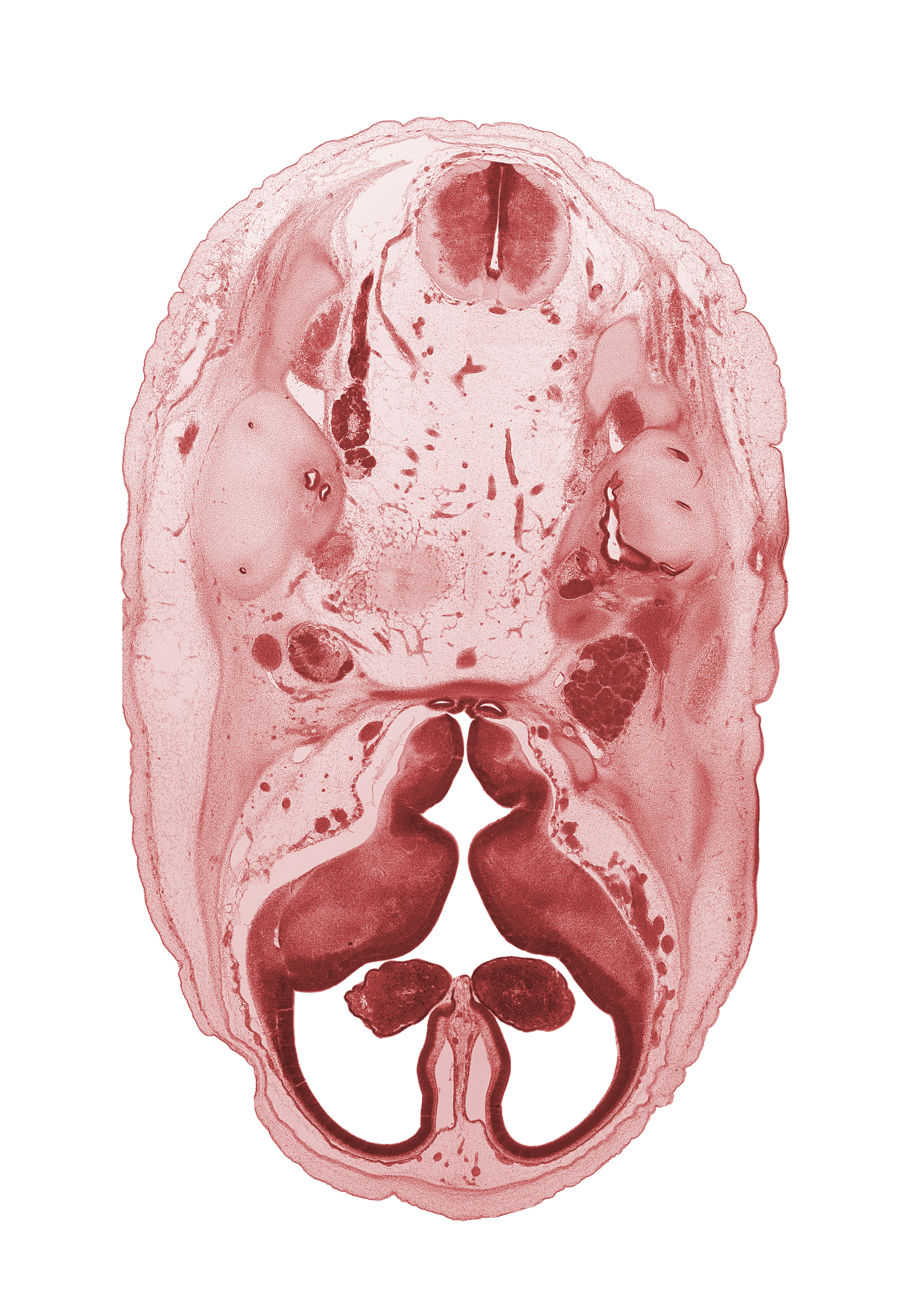 basilar artery, central canal, corpus striatum, edge of pons region (metencephalon), facial nerve (CN VII), glossopharyngeal nerve (CN IX), hippocampus, hypothalamus, intermediate zone, internal carotid artery, internal jugular vein, interventricular foramen, junction of brain and spinal cord, marginal zone, medial ventricular eminence (diencephalon), neurohypophysis, optic groove, otic capsule cartilage, root of hypoglossal nerve (CN XII), semicircular duct, trigeminal ganglion (CN V), tuberal part of adenohypophysis, vagus nerve (CN X), ventricular zone