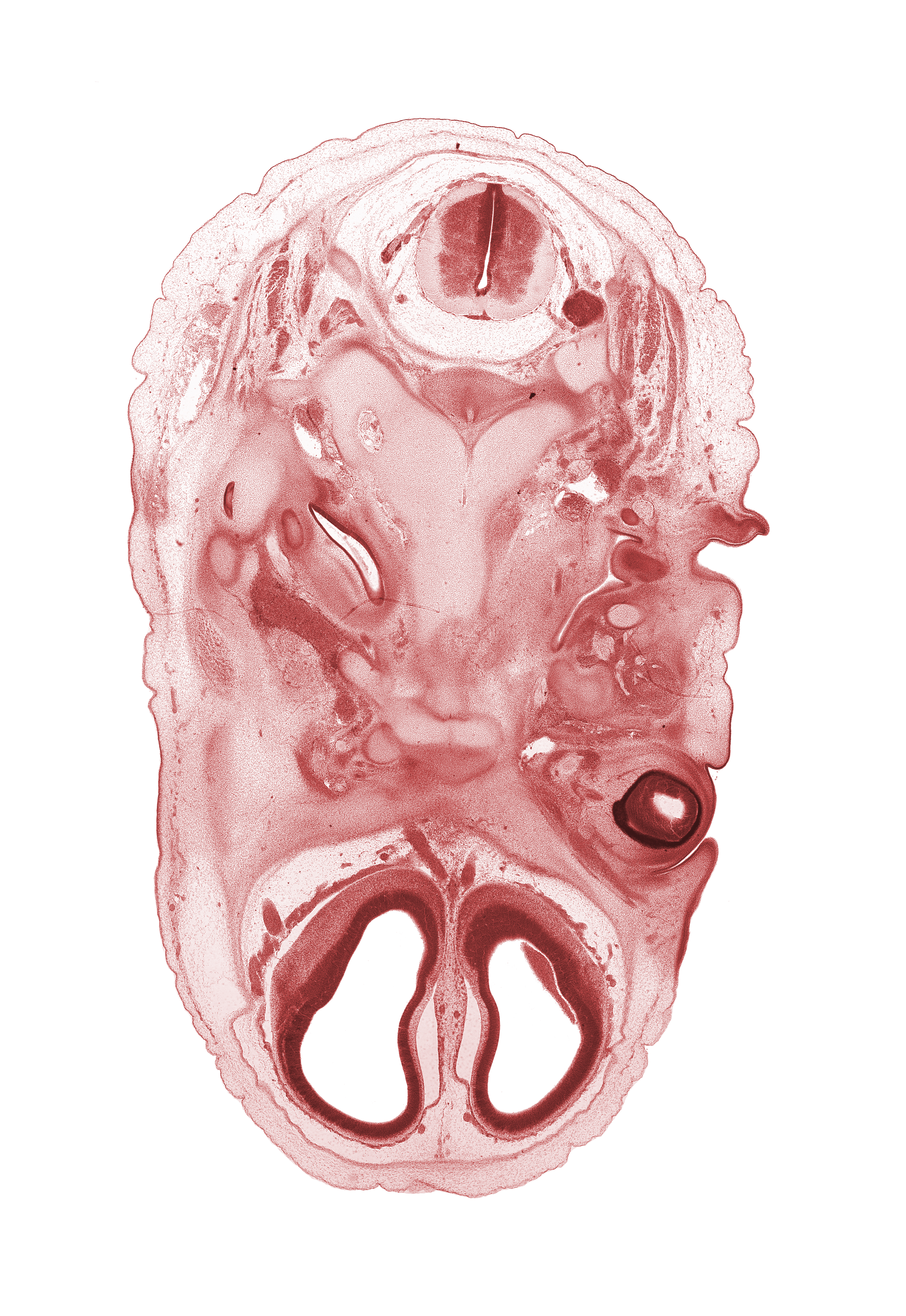 C-2 spinal ganglion, accessory nerve (CN XI), anterior cerebral artery, artifact separation(s), basi-occipital (basal plate), basisphenoid, cochlear duct, external acoustic meatus, facial nerve (CN VII), falx cerebri region, hypoglossal canal, hypoglossal nerve (CN XII), inferior ganglion of glossopharyngeal nerve (CN IX), intermediate zone, internal jugular vein, malleus cartilage, marginal zone, maxillary nerve (CN V₂), optic nerve (CN II), pharyngotympanic tube, spinal accessory nerve (CN XI), subarachnoid space, vagus nerve (CN X), ventricular zone