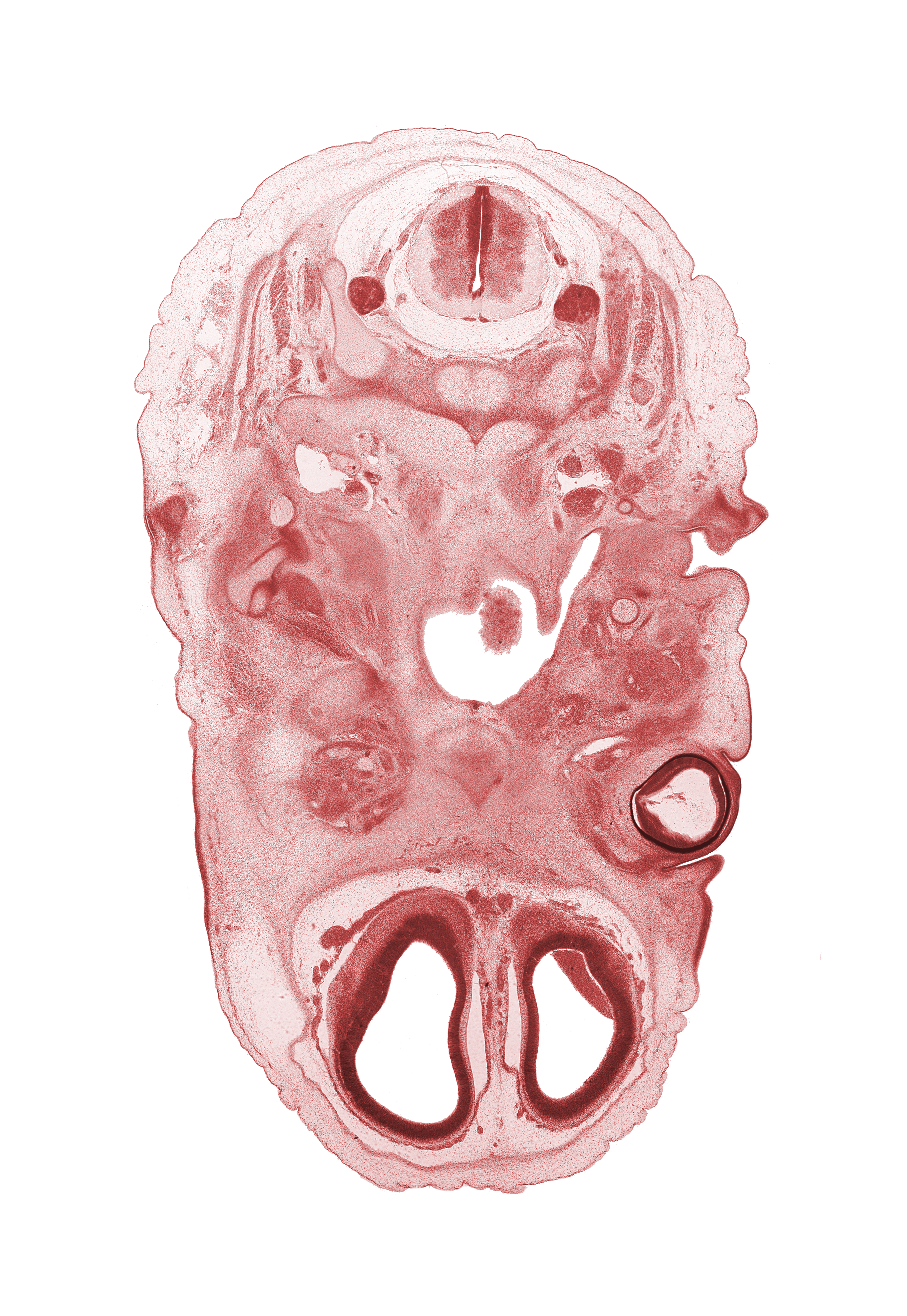 C-2 spinal ganglion, anterior communicating artery, artifact separation(s), basisphenoid, blastema of extra-ocular muscle(s), cerebral vesicle (telencephalon), cornea, dens of C-2 vertebra (axis), edge of tongue, external acoustic meatus, hypoglossal nerve (CN XII), internal carotid artery, internal jugular vein, intraretinal space (optic vesicle cavity), malleus cartilage, nasopharynx, olfactory bulb, optic cup cavity, pharyngotympanic tube, spinal accessory nerve (CN XI), subarachnoid space, vagus nerve (CN X), vertebral artery