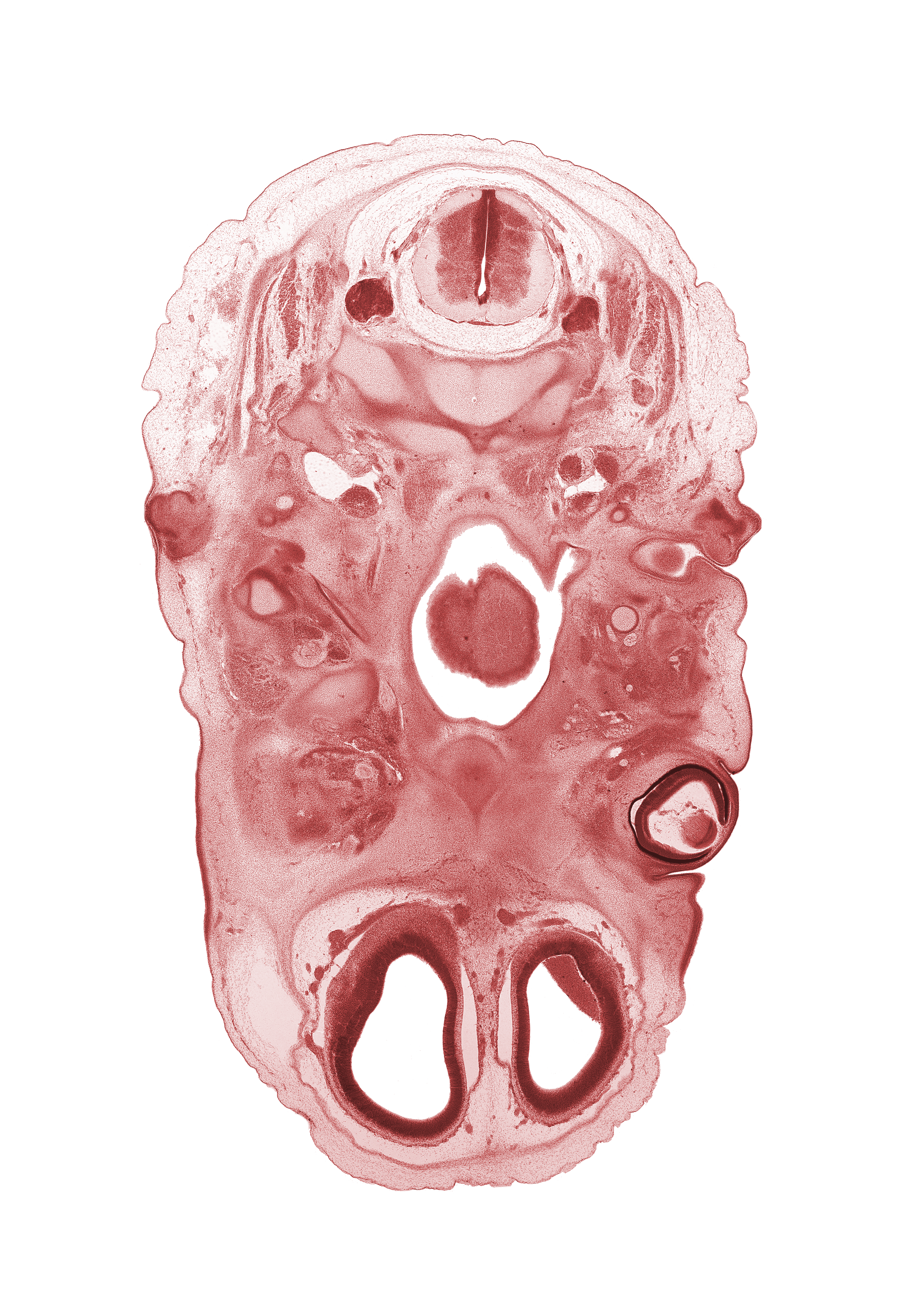 C-2 spinal ganglion, C-2 spinal nerve, C-2 vertebra (axis), accessory nerve (CN XI), artifact separation(s), blastema of extra-ocular muscle(s), blastemata of mastication muscles, edge of lens, foramen cecum of tongue, glossopharyngeal nerve (CN IX), inferior ganglion of vagus nerve (CN X), internal carotid artery, internal jugular vein, nasopharynx, neural layer of retina, olfactory bulb, osteogenic layer, pharyngeal arch 1 cartilage (Meckel), pharyngeal arch 2 cartilage, pigmented layer of retina, subarachnoid space