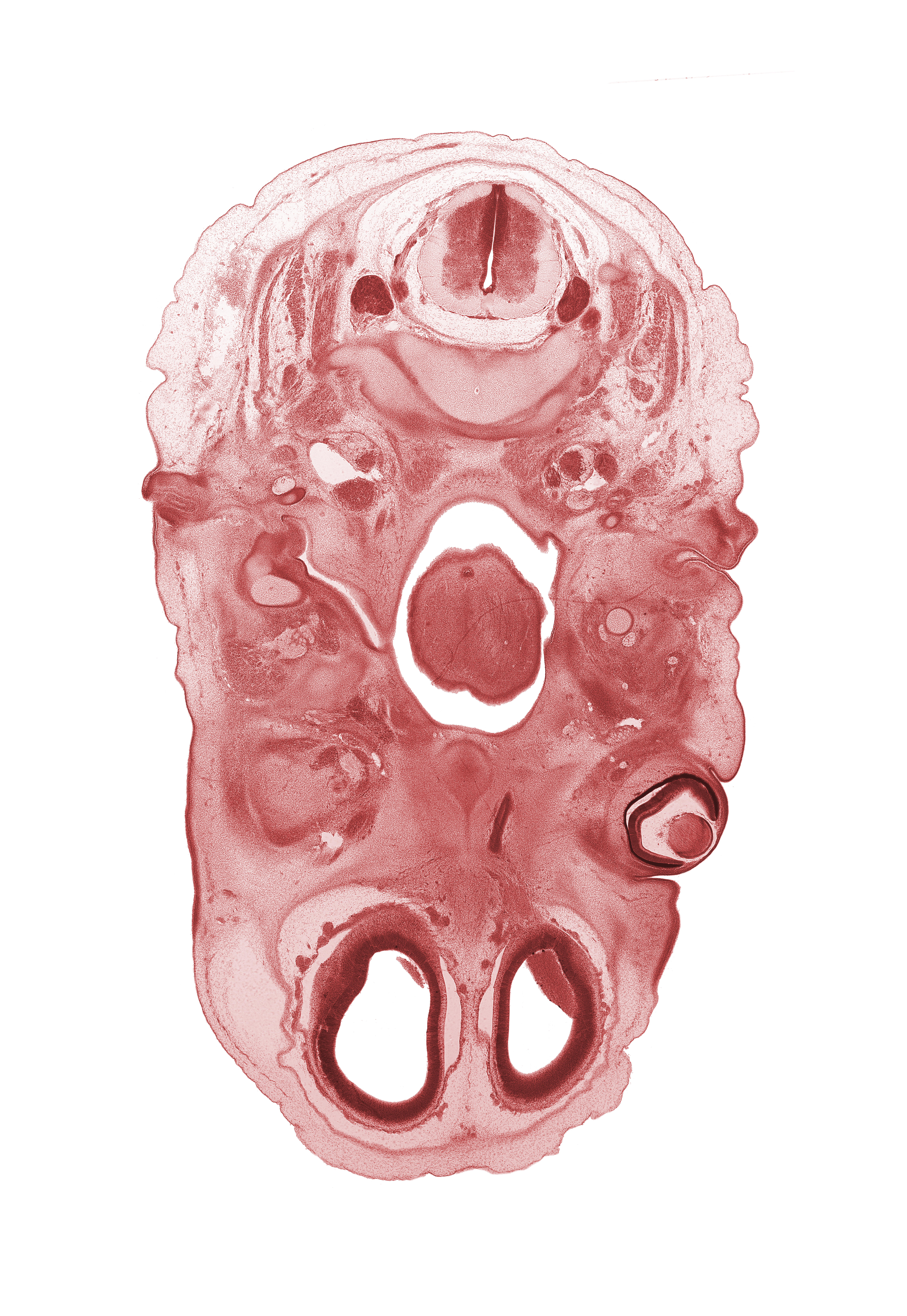 C-2 spinal ganglion, C-3 spinal ganglion, artifact separation(s), atlanto-axial joint, blastema of extra-ocular muscle(s), centrum of C-2 vertebra (axis), cornea, dorsum of tongue, edge of nasal ectoderm, glossopharyngeal nerve (CN IX), inferior ganglion of vagus nerve (CN X), internal jugular vein, lateral ventricle, lens, lower eyelid, nasopharynx, olfactory filia (CN I), oral cavity, oropharynx, pharyngeal arch 1 cartilage (Meckel), subarachnoid space, thyroglossal duct, upper eyelid