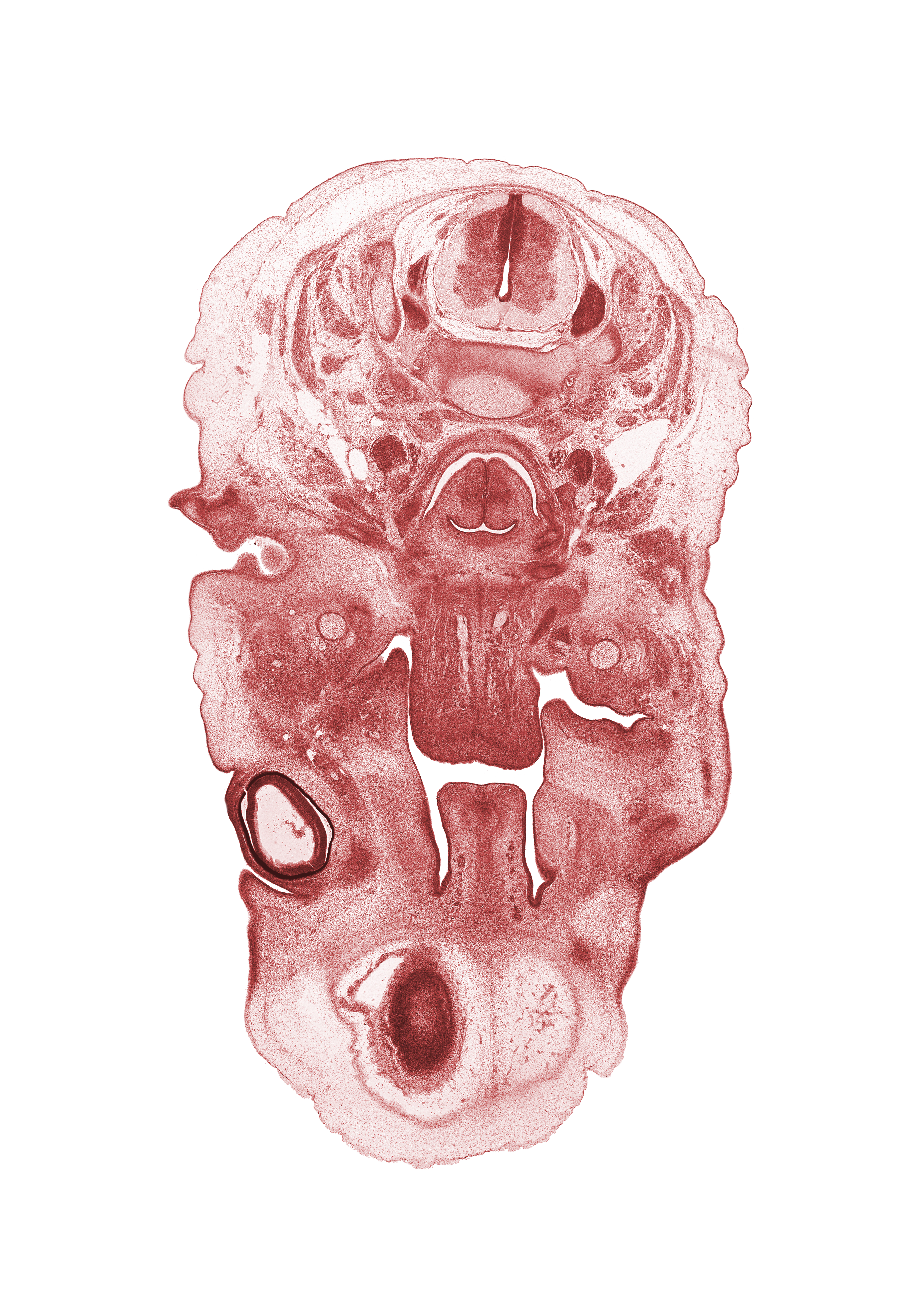 C-3 / C-4 intervertebral disc, C-4 spinal ganglion, C-4 spinal nerve, cerebral vesicle (telencephalon), choana, crista galli, ethmoid condensation, external acoustic meatus, falx cerebri region, infra-orbital region, internal carotid artery, lower eyelid, nasal cavity (nasal sac), neural layer of retina, oral cavity, palatine shelf, pigmented layer of retina, spinal accessory nerve (CN XI), splenius muscle, sternocleidomastoid muscle, subarachnoid space, trapezius muscle, upper eyelid
