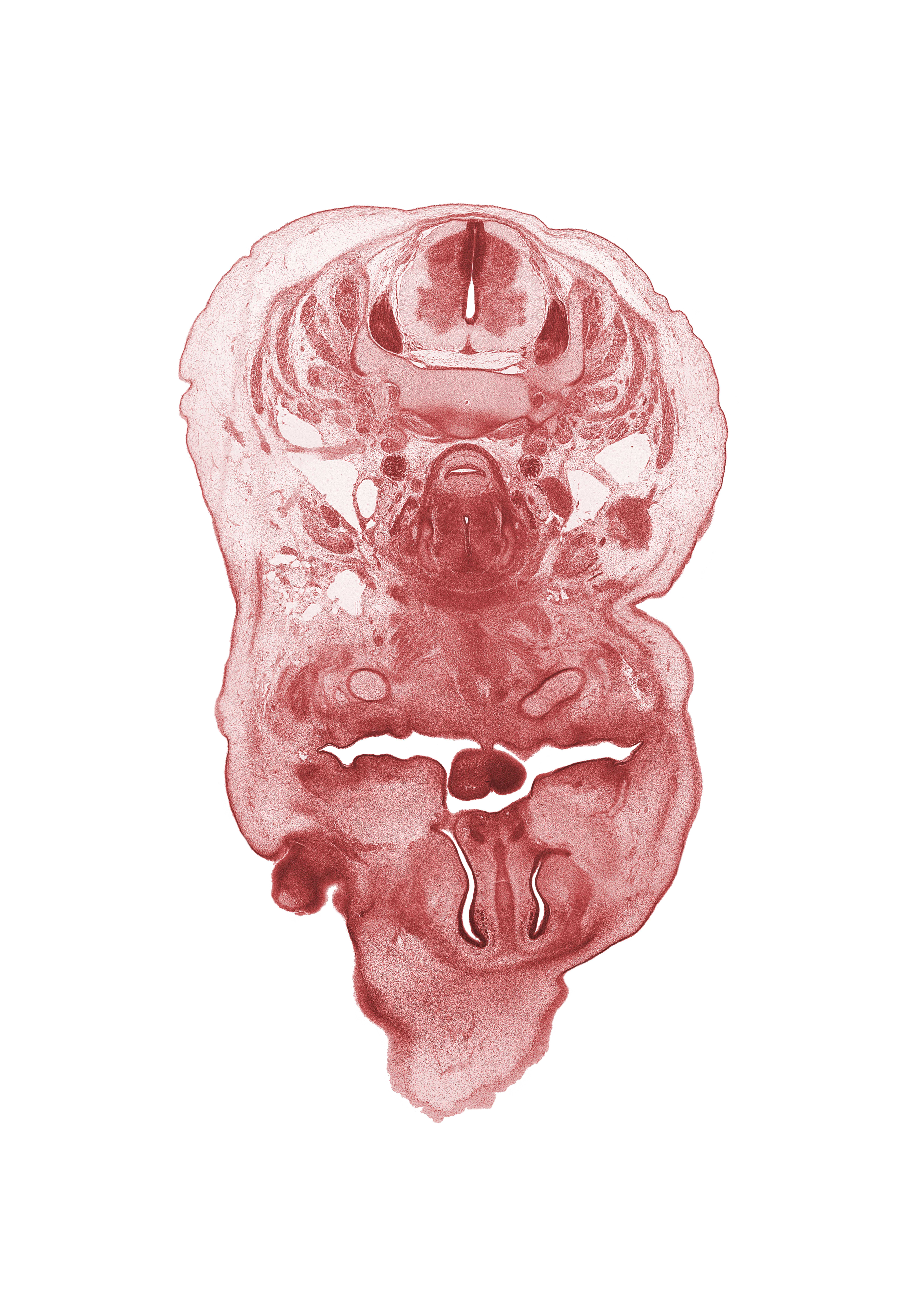 C-5 spinal ganglion, anterior spinal artery, caudal edge of eyeball, external jugular vein, frenulum of tongue, internal carotid artery, interorbital ligament, jugular lymph sac, laryngeal condensation, longus cervicis muscle, nasal capsule, nasal cavity (nasal sac), nasal septal cartilage, oral cavity, pharyngeal arch 1 cartilage (Meckel), platysma muscle, semispinalis capitis muscle, semispinalis cervicis muscle, splenius muscle, sternocleidomastoid muscle, subarachnoid space, superior parathyroid gland, trapezius muscle