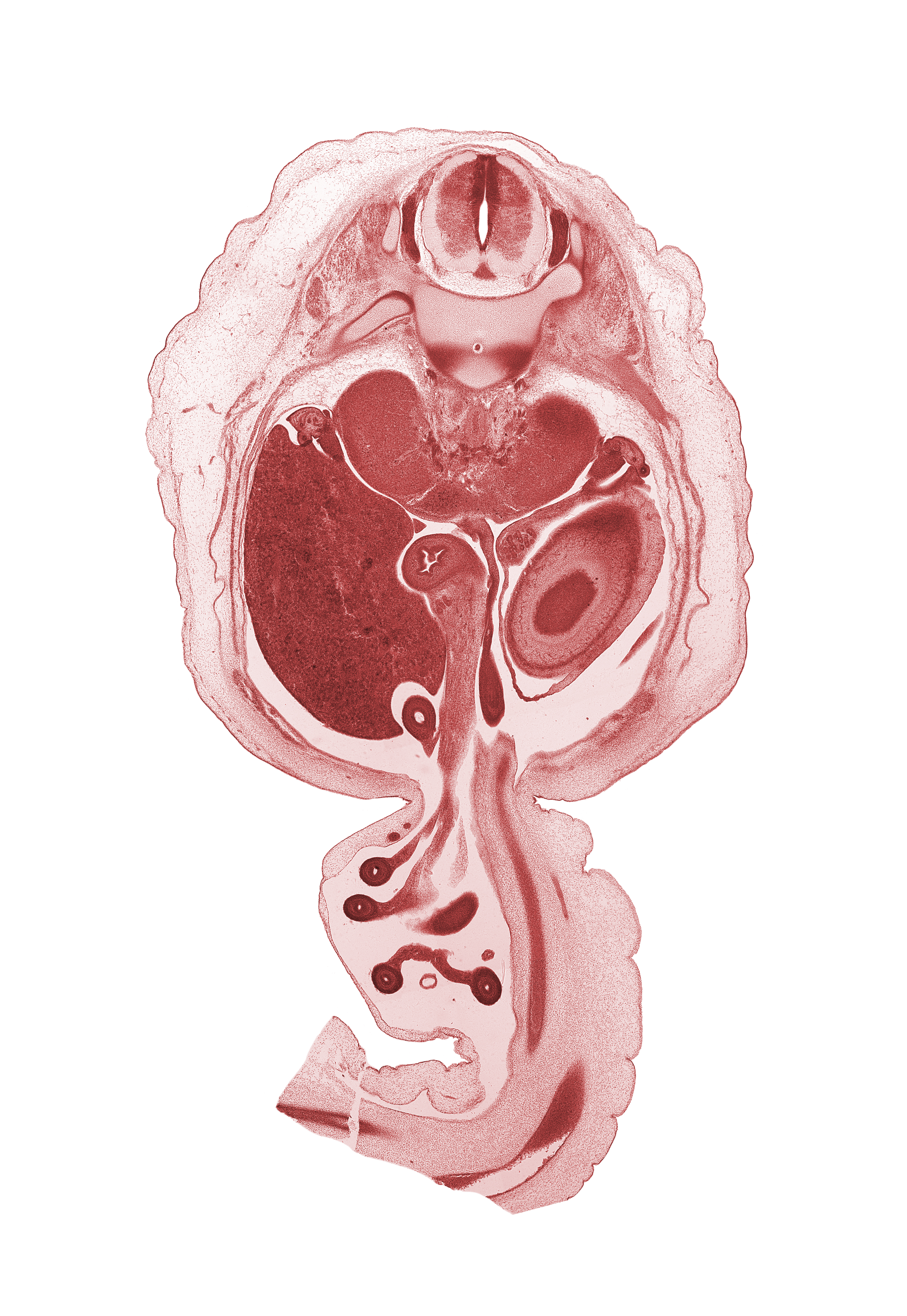 T-12 / L-1 intervertebral disc, T-12 spinal ganglion, T-12 ventral root, allantois, aorta, body of dorsal pancreas, caudal edge of left lobe of liver, distal limb of herniated midgut, dorsal mesogastrium, duodenum, hindgut (colon), jejunum, left umbilical artery, lesser sac (omental bursa), mesentery, mesocolon, notochord, omphalomesenteric artery, proximal limb of herniated midgut, right lobe of liver, superior mesenteric ganglion, suprarenal gland medulla, sympathetic trunk, testis, umbilical vein